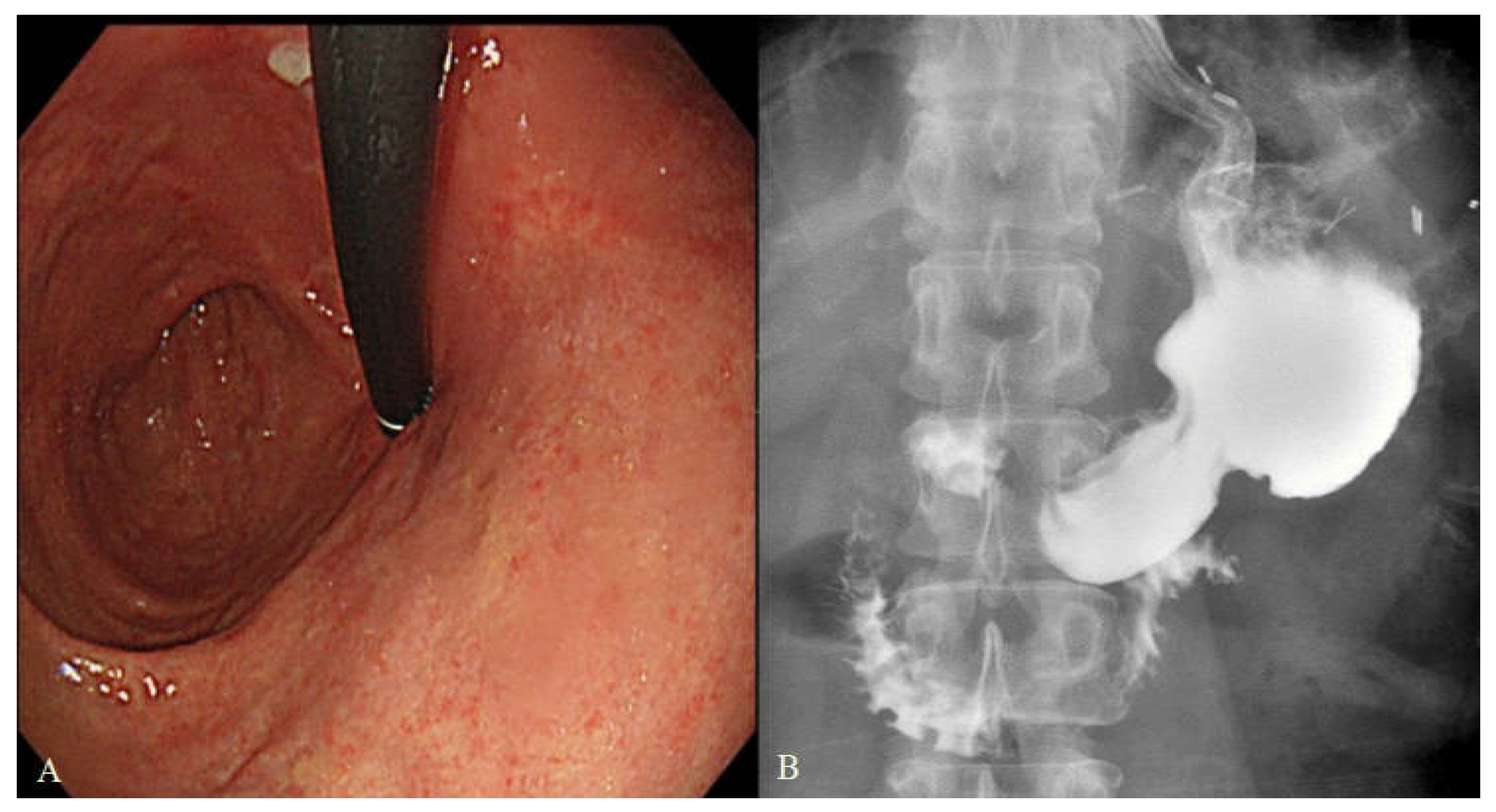 Cancers 14 00379 g002