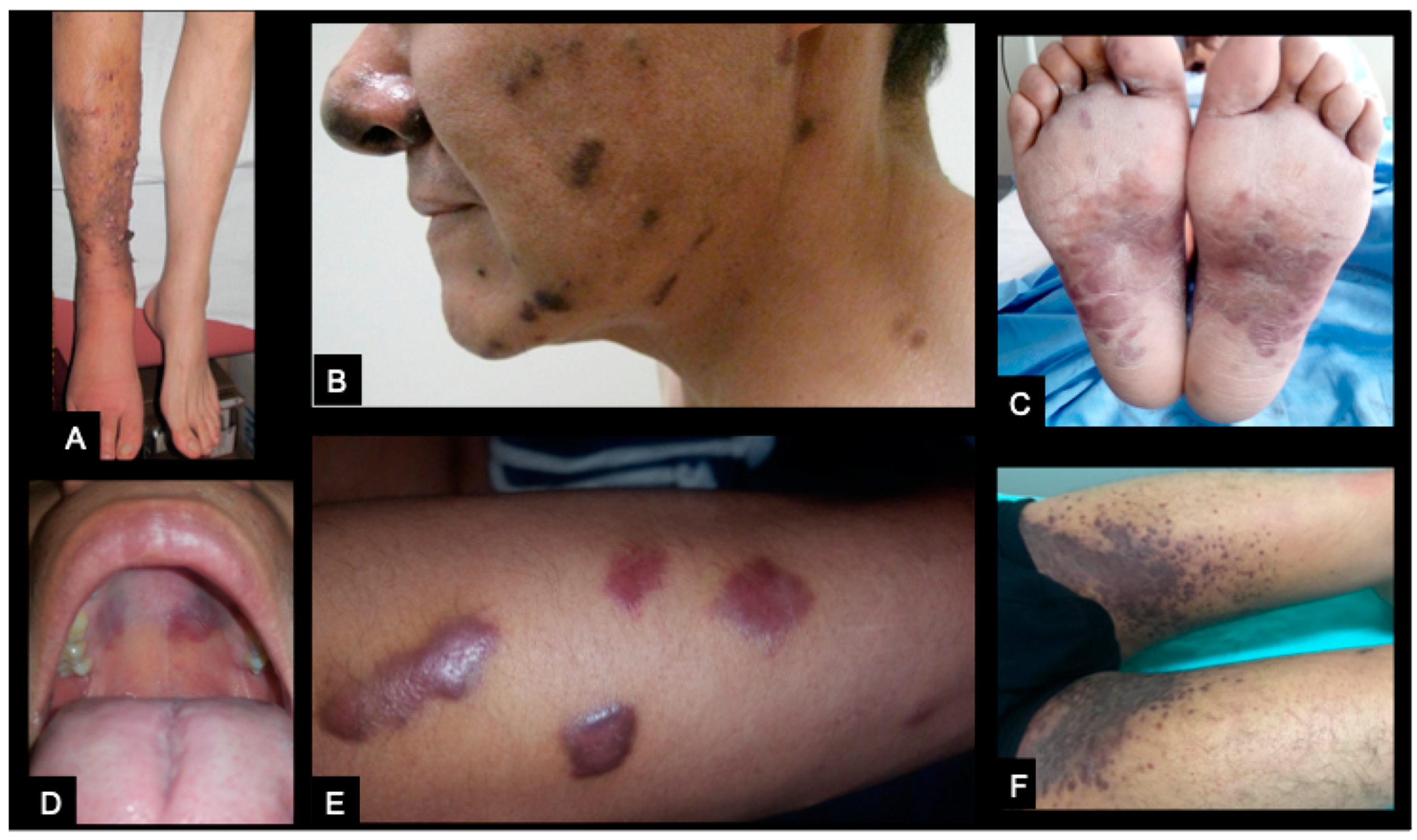 Cancers 14 00412 g001