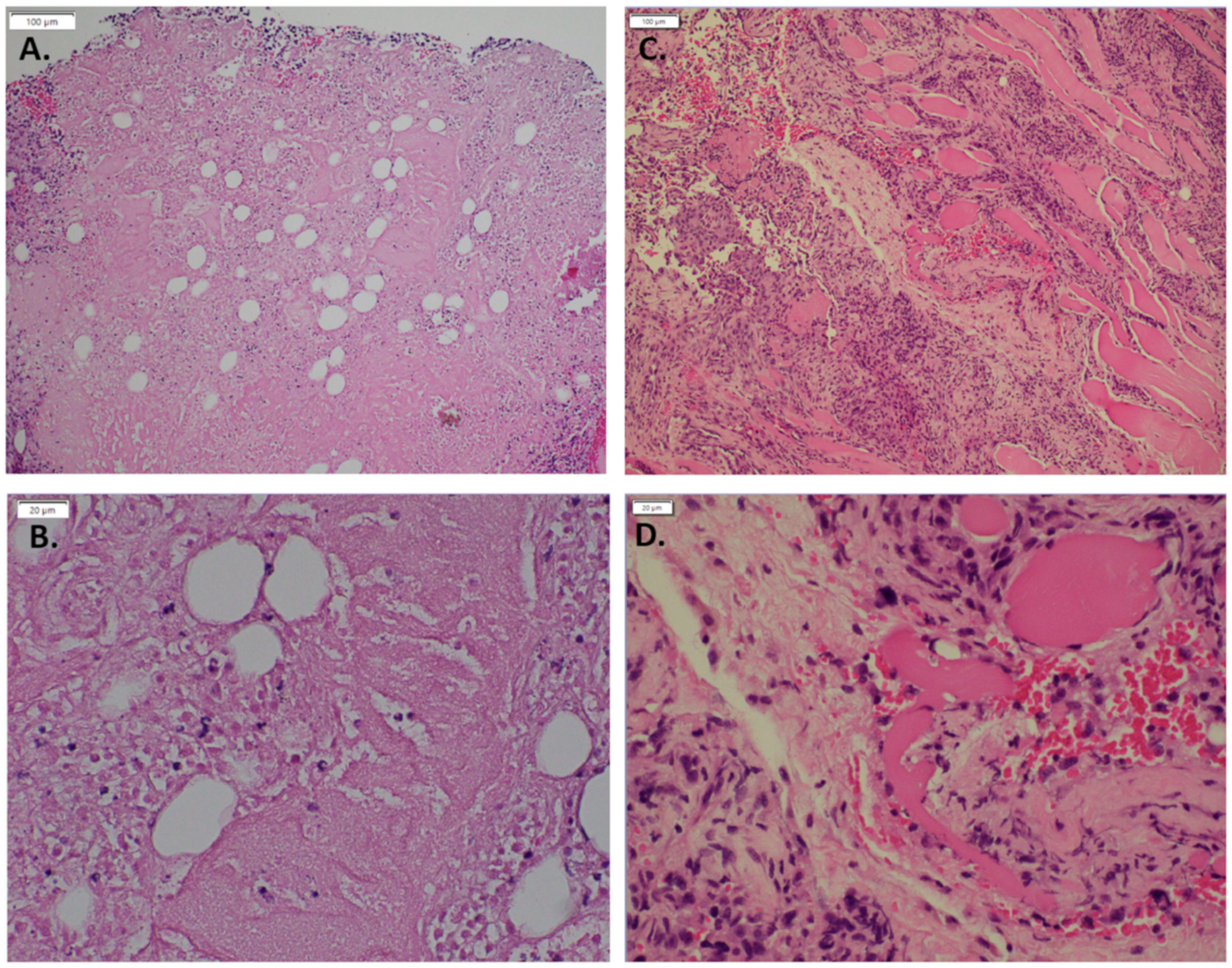 Cancers 14 00413 g001