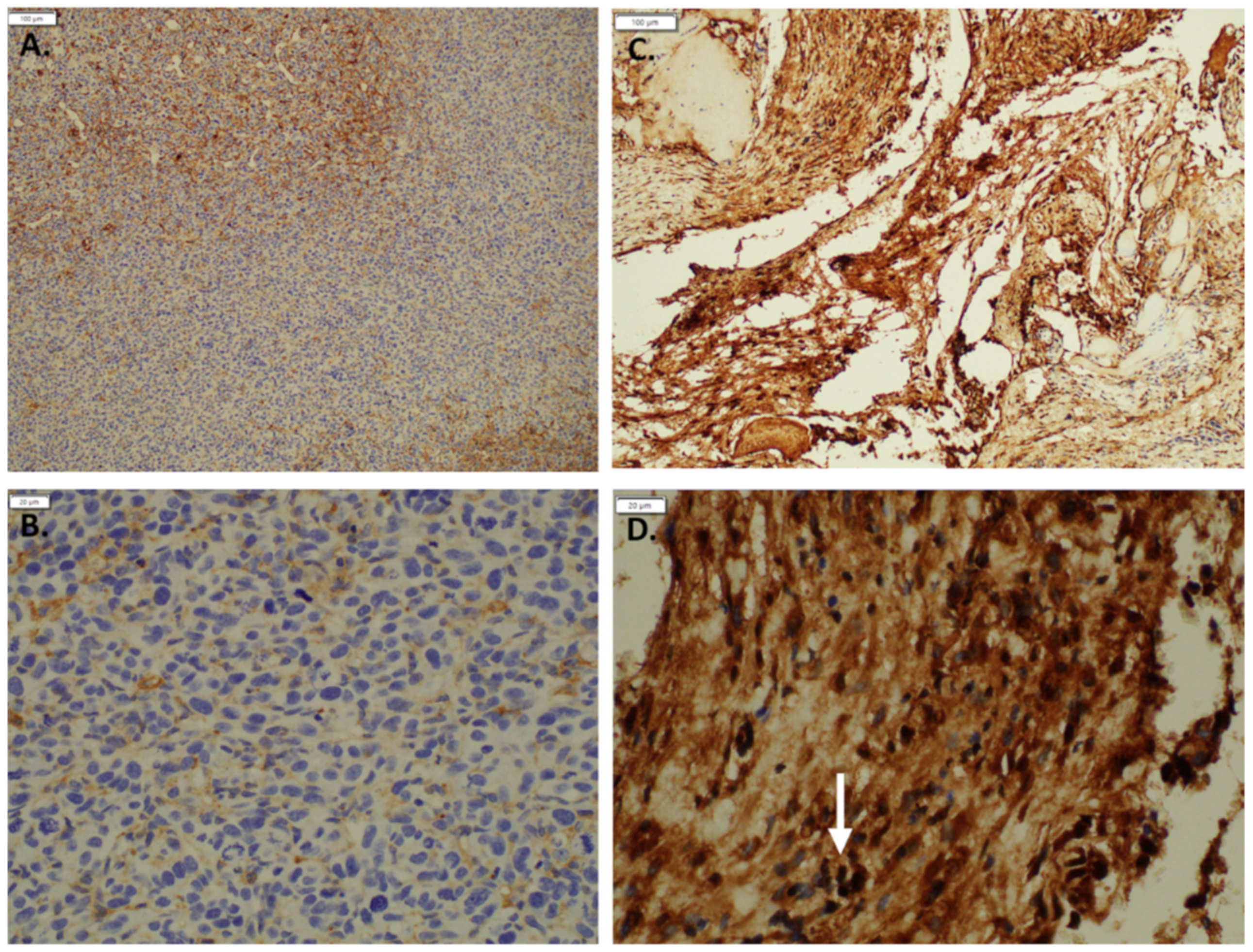 Cancers 14 00413 g003