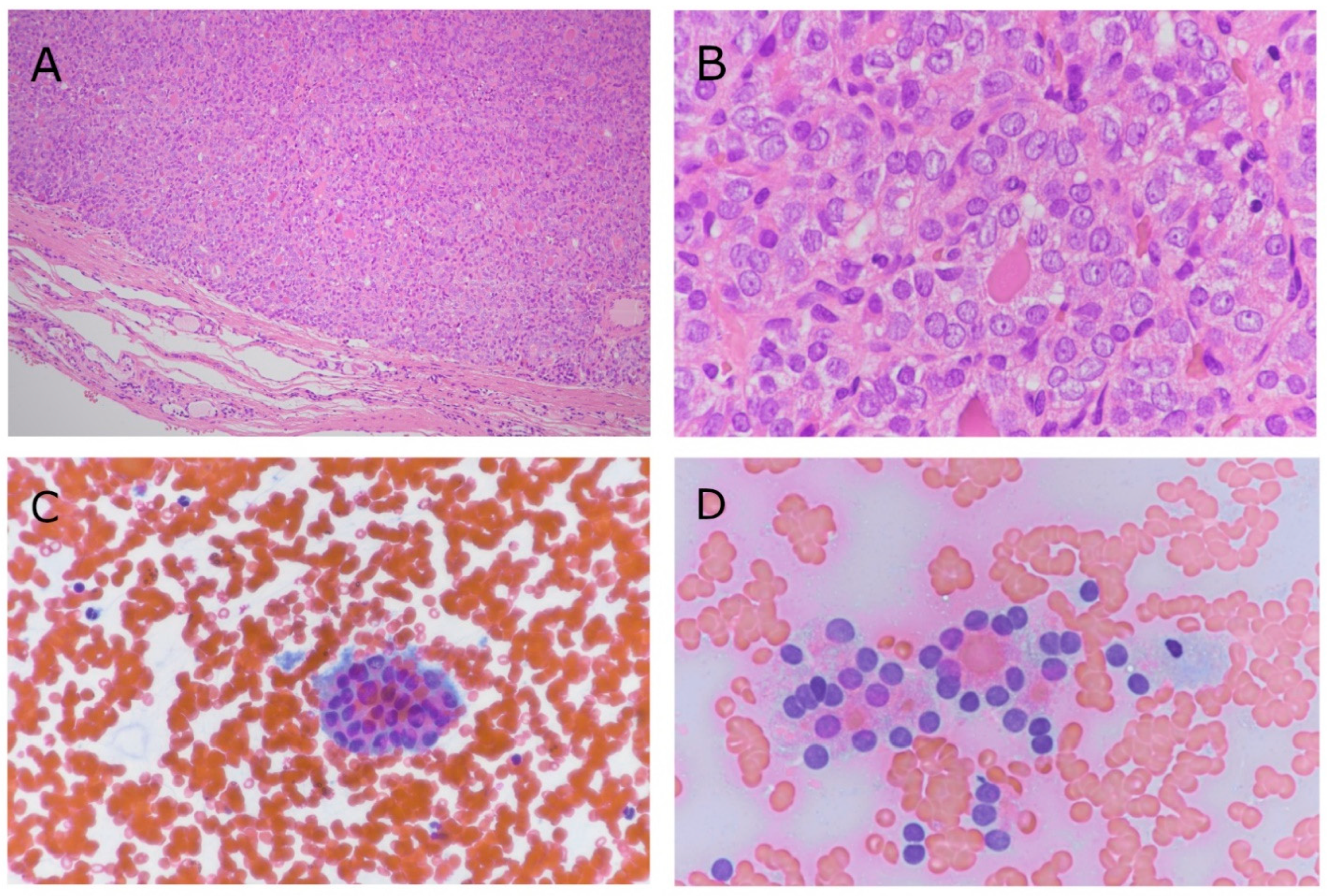 Cancers 14 00420 g001