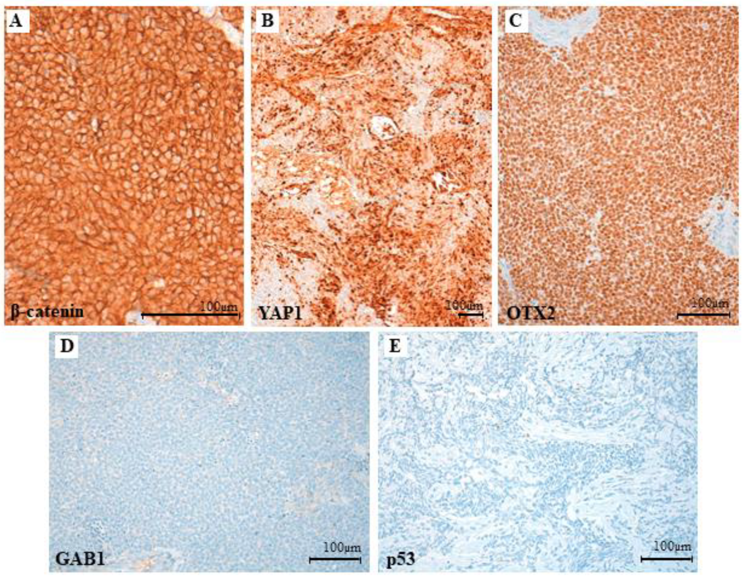 Cancers 14 00421 g005