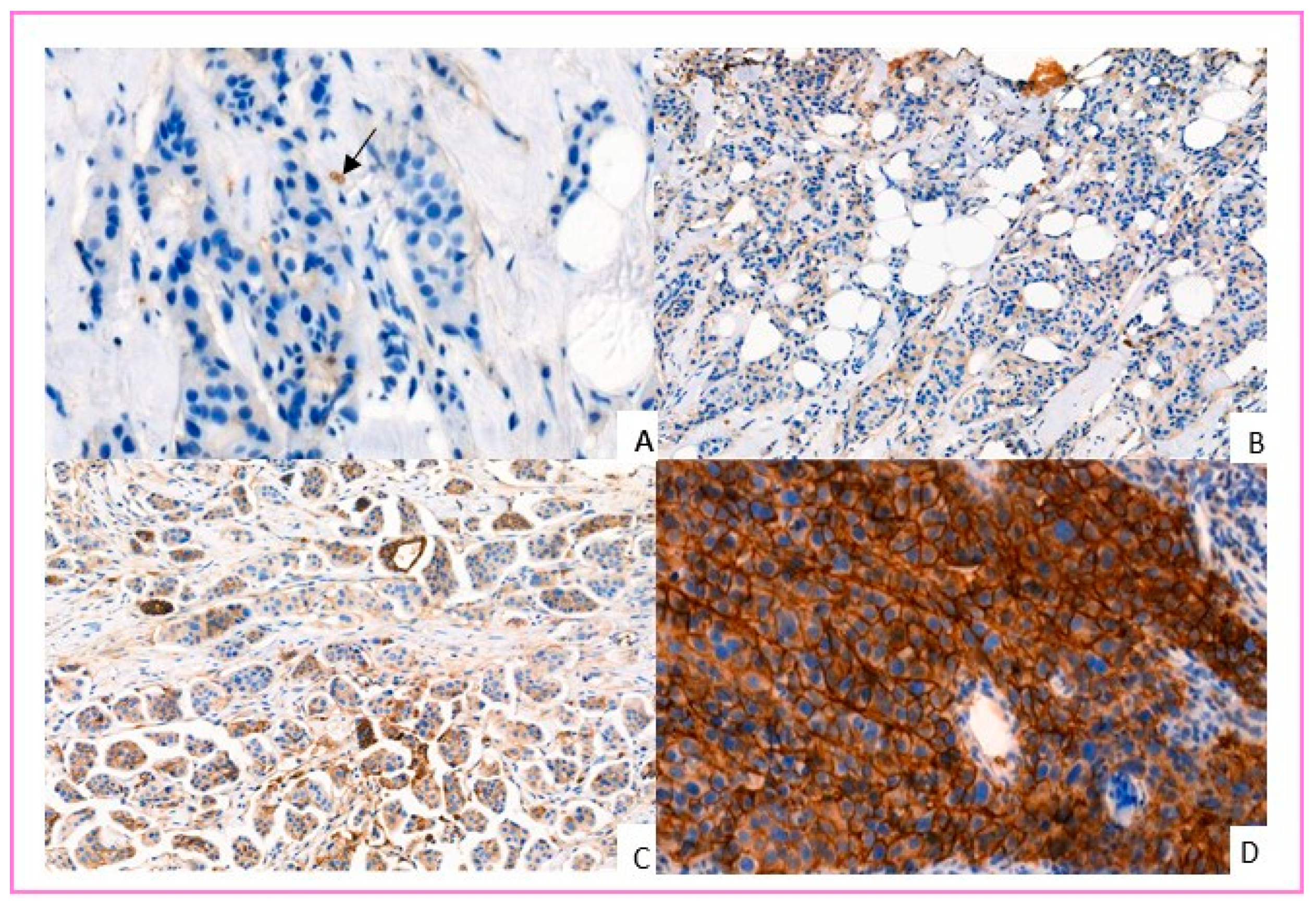 Cancers 14 00437 g001