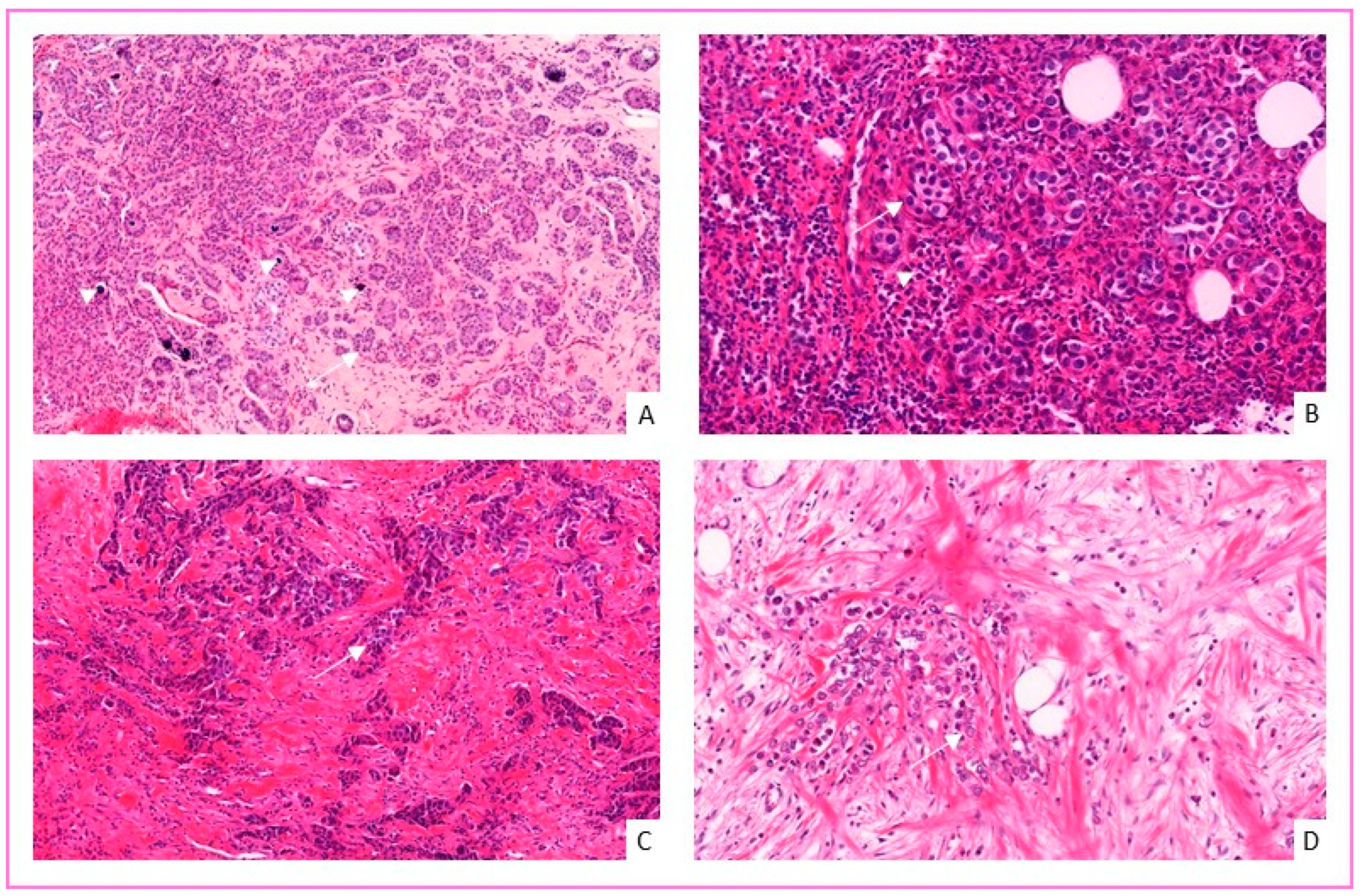 Cancers 14 00437 g002