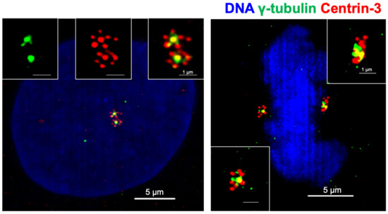 rann様 Keep Calm and Carry on with Extra Centrosomes