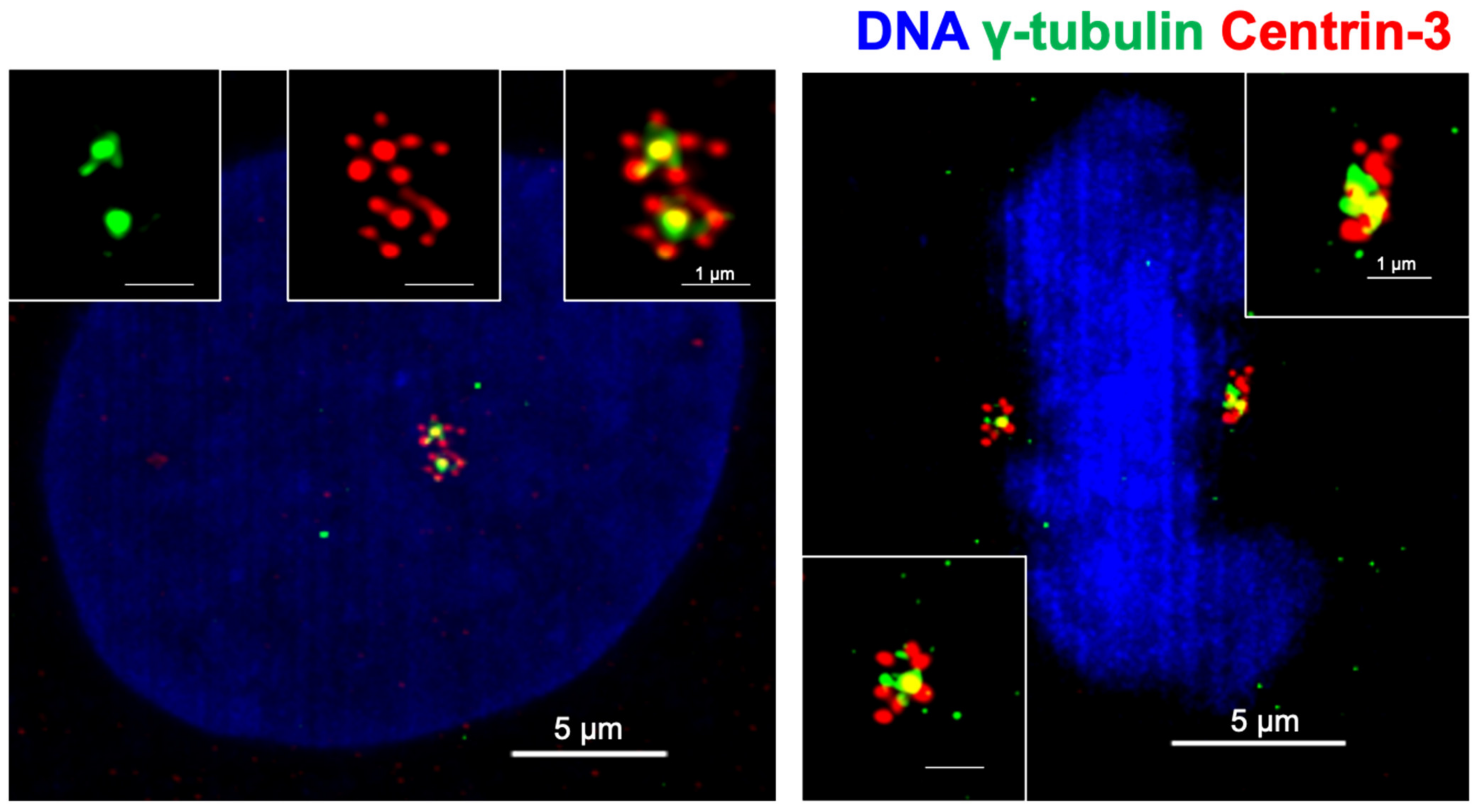 Keep Calm and Carry on with Extra Centrosomes
