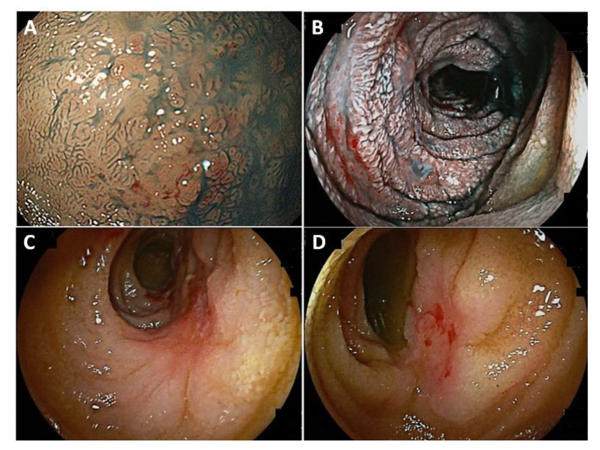 Cancers 14 00446 g001 Cancers 14 00446 g001