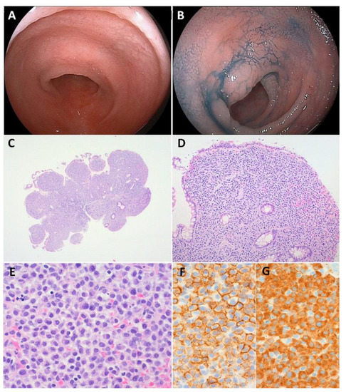 平沢 Design, Synthesis, and Biological Evaluation of Covalently
