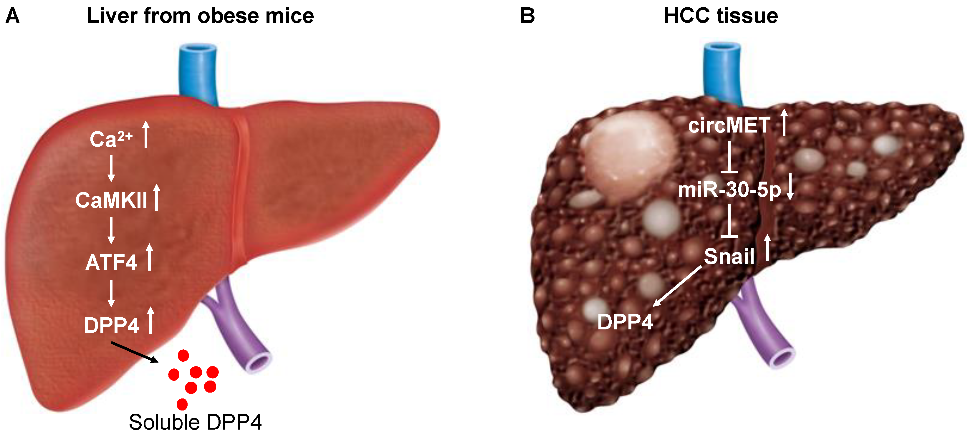 CD26/DPP4 as a Therapeutic Target in Nonalcoholic