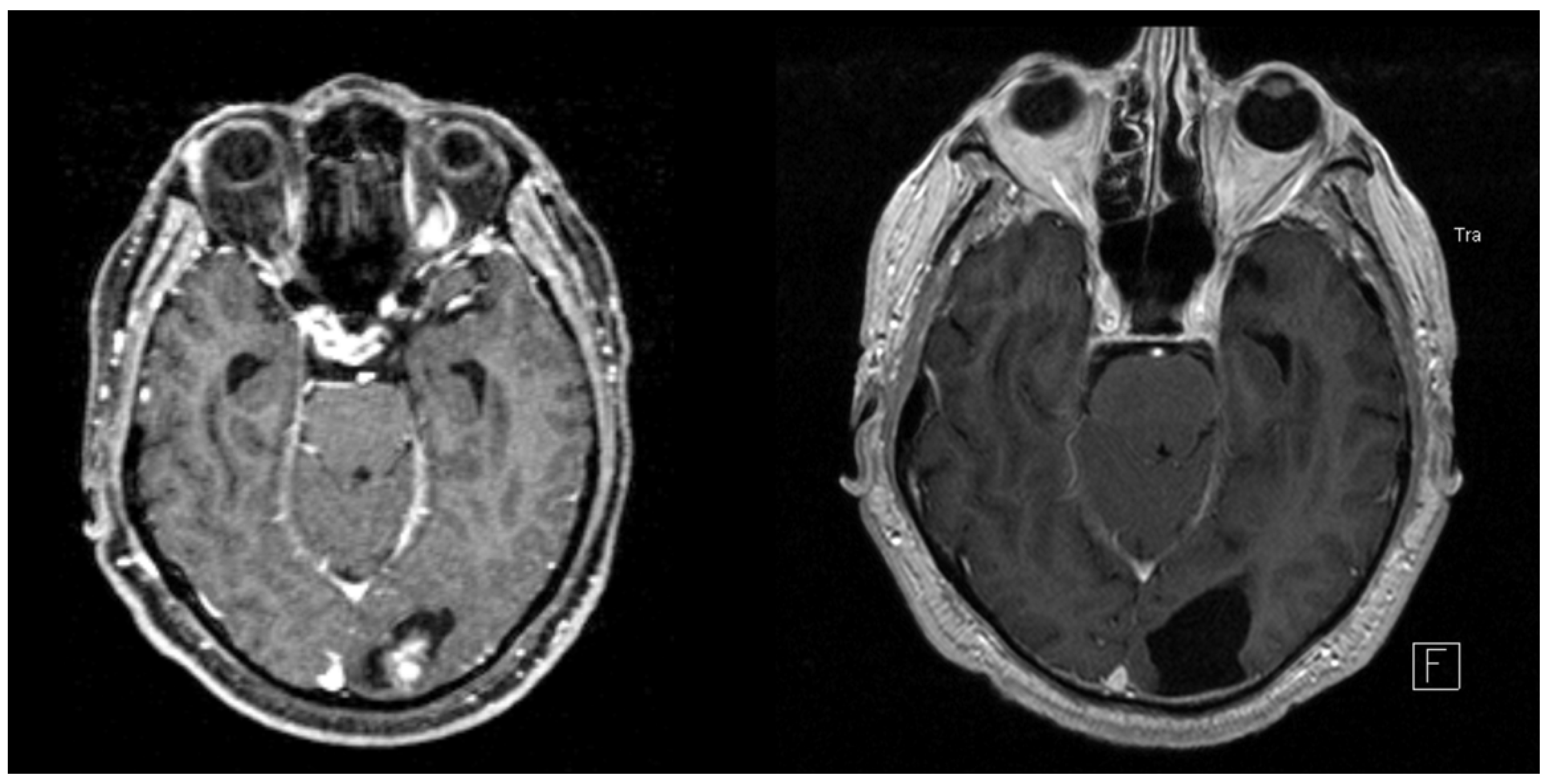 Cancers 14 00465 g005