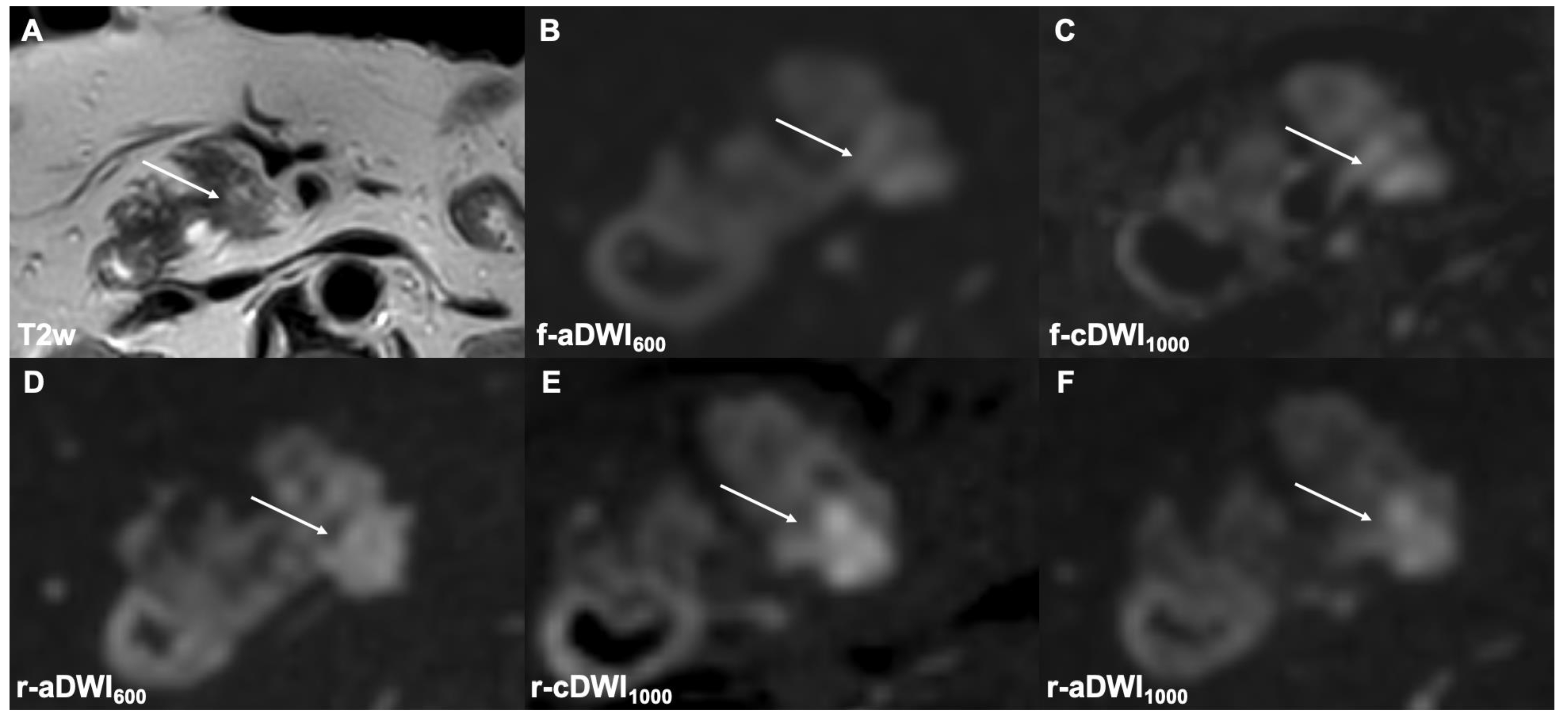 Cancers 14 00470 g003