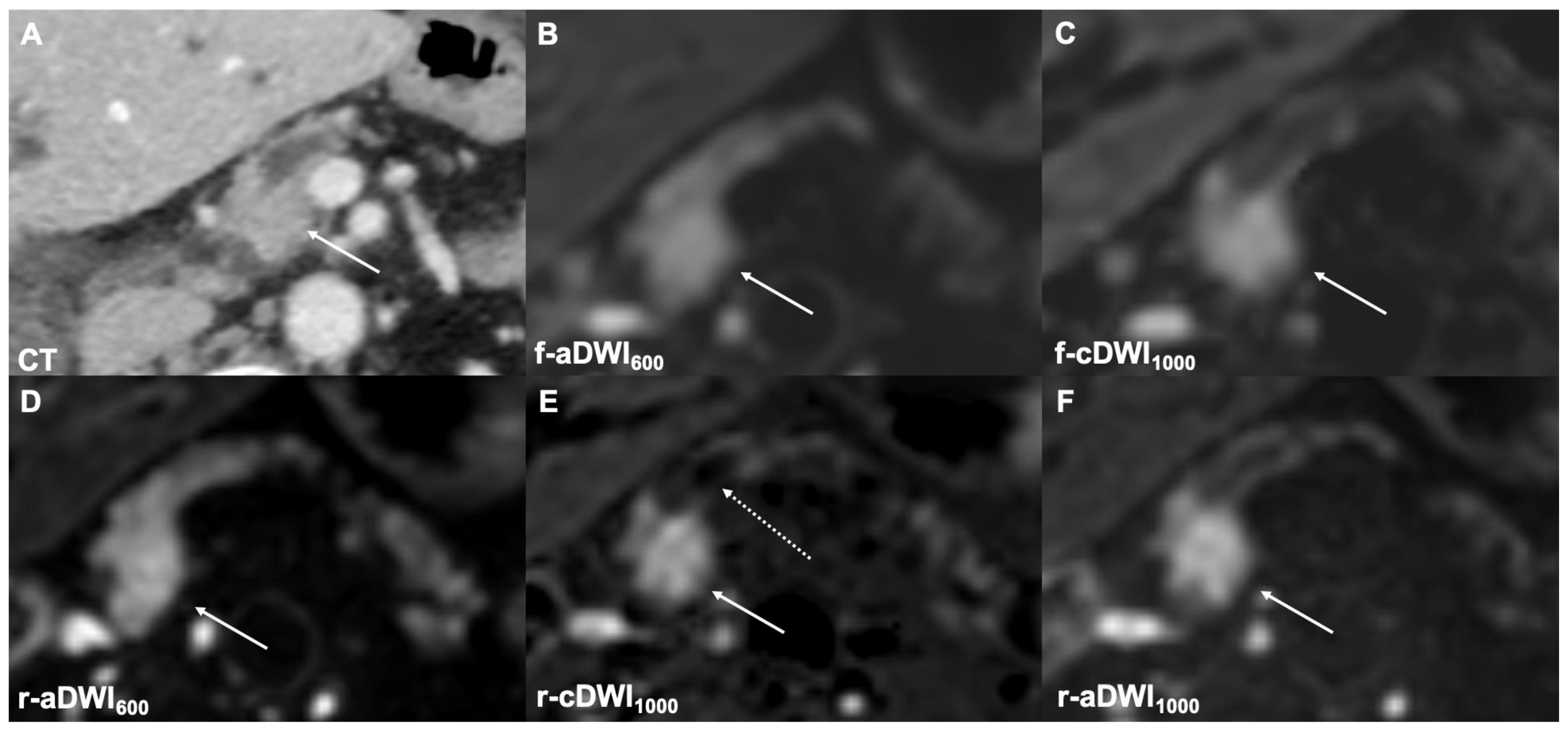 Cancers 14 00470 g004