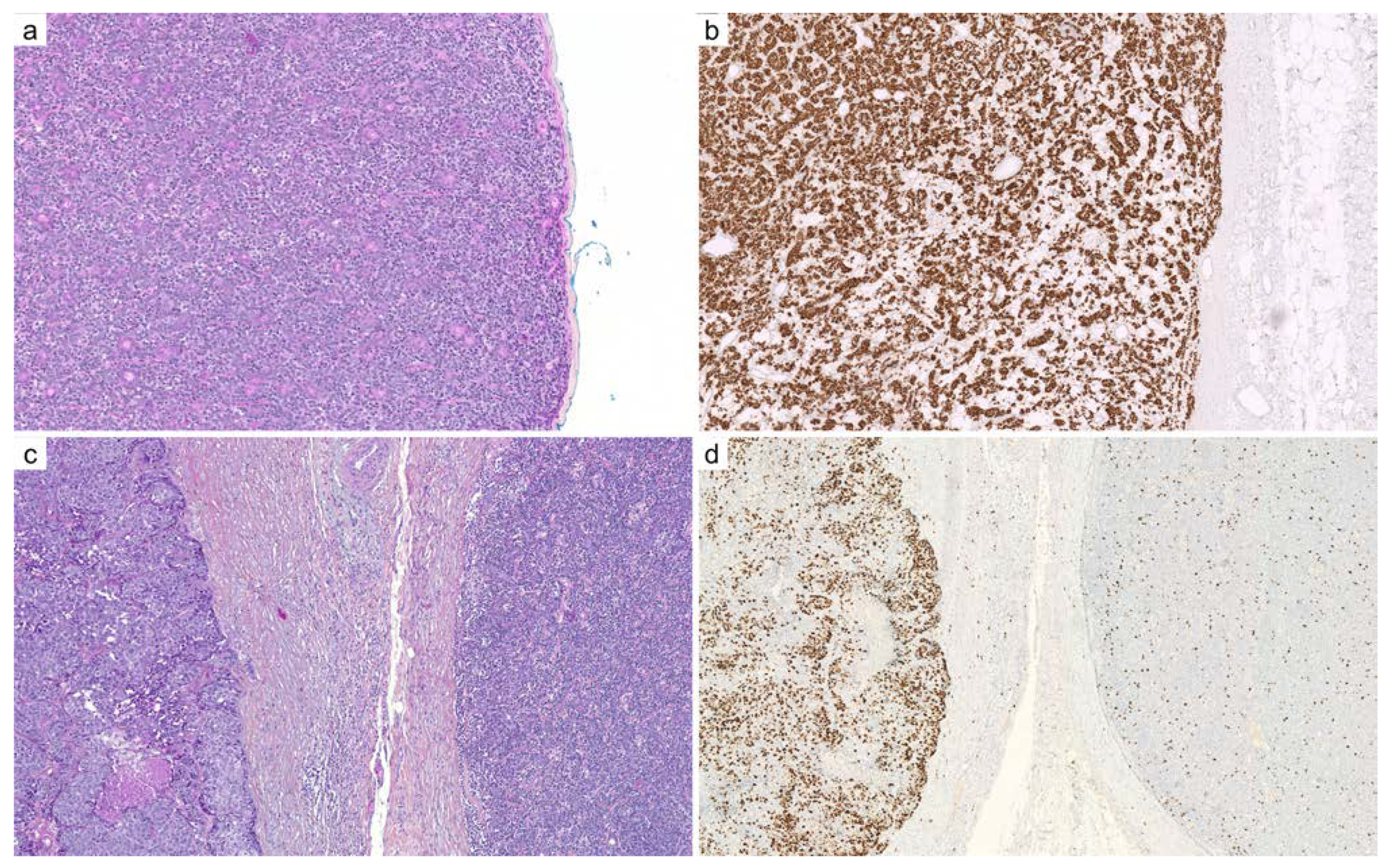 Cancers 14 00476 g003