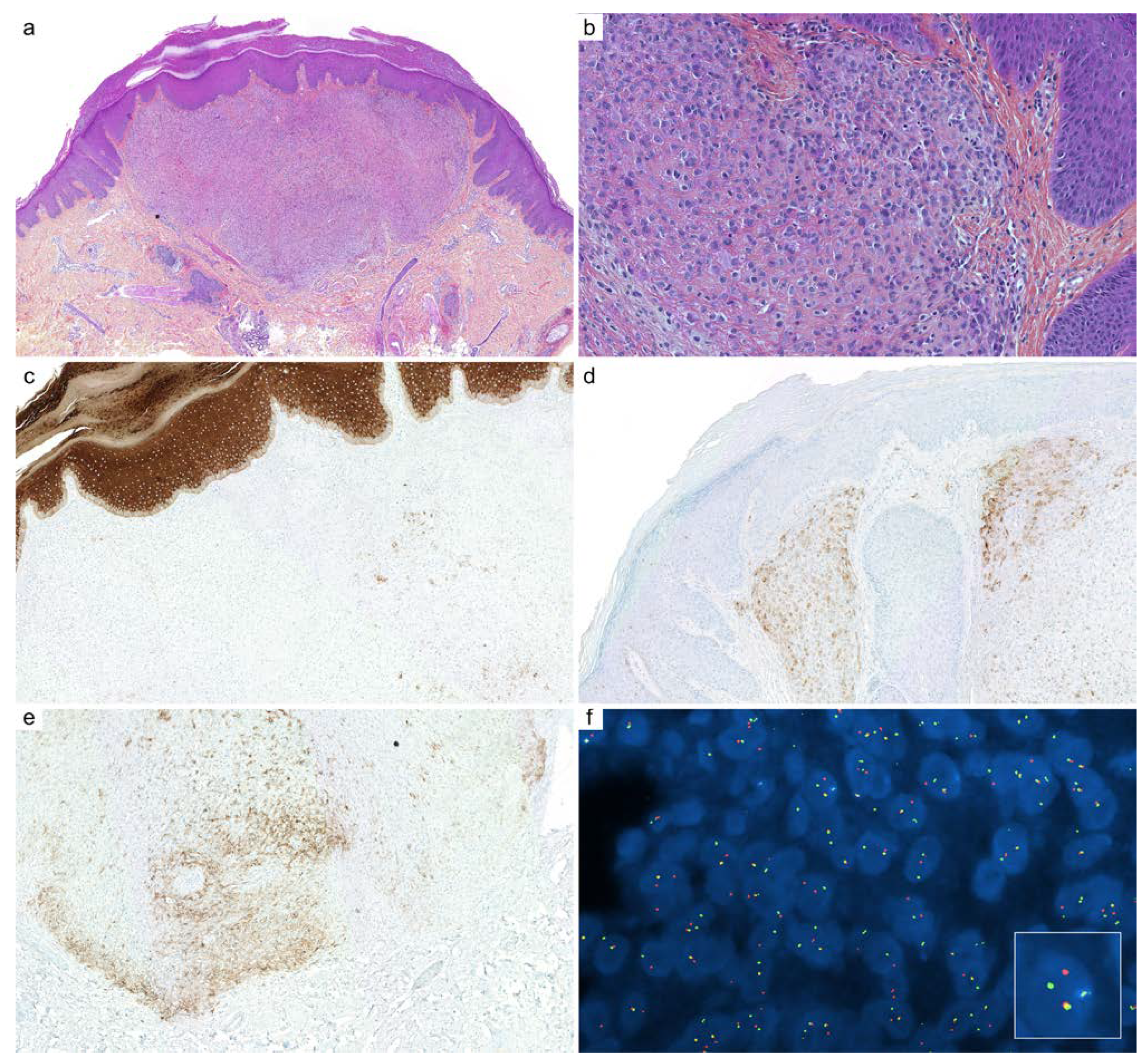 Cancers 14 00476 g005