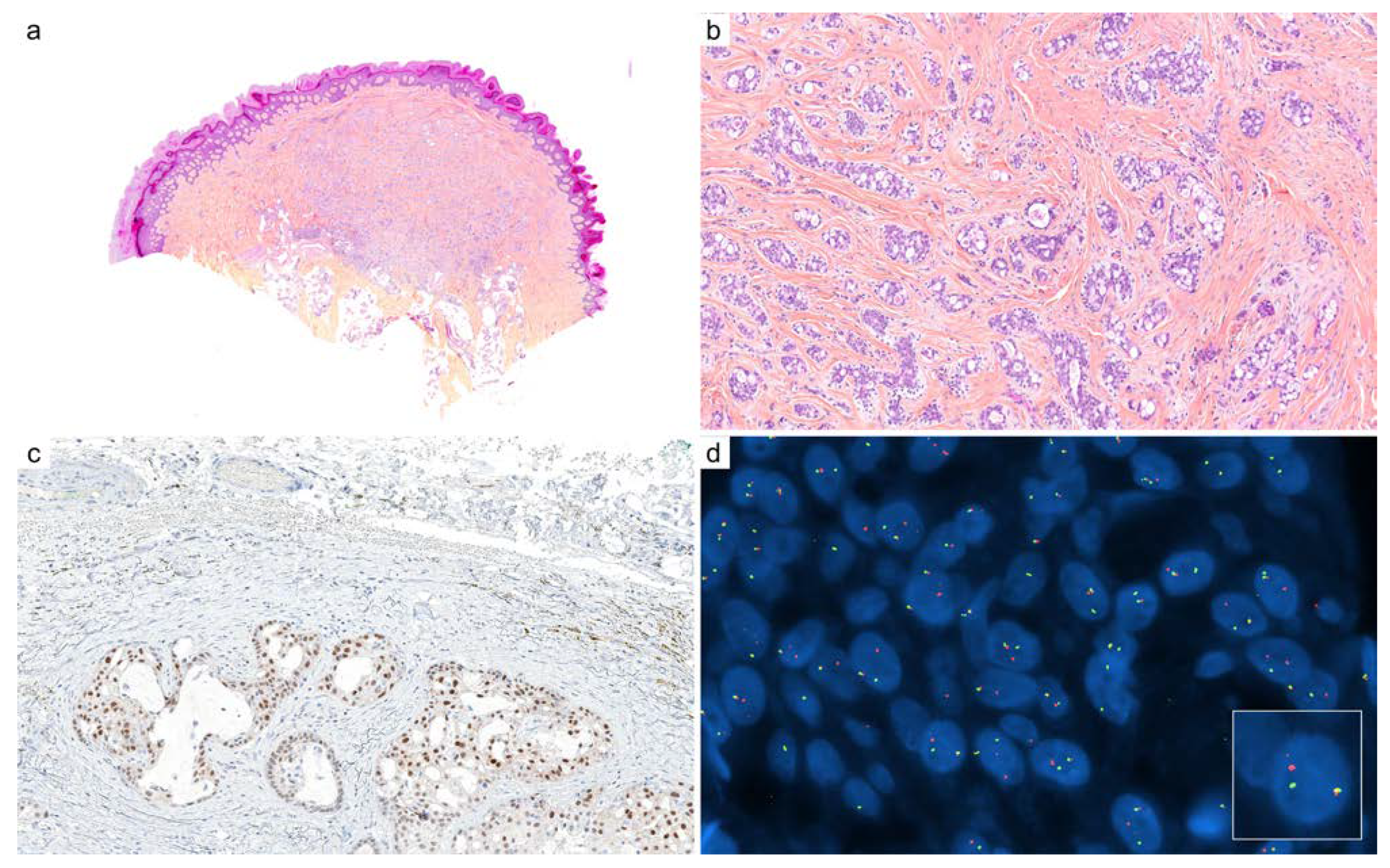 Cancers 14 00476 g007