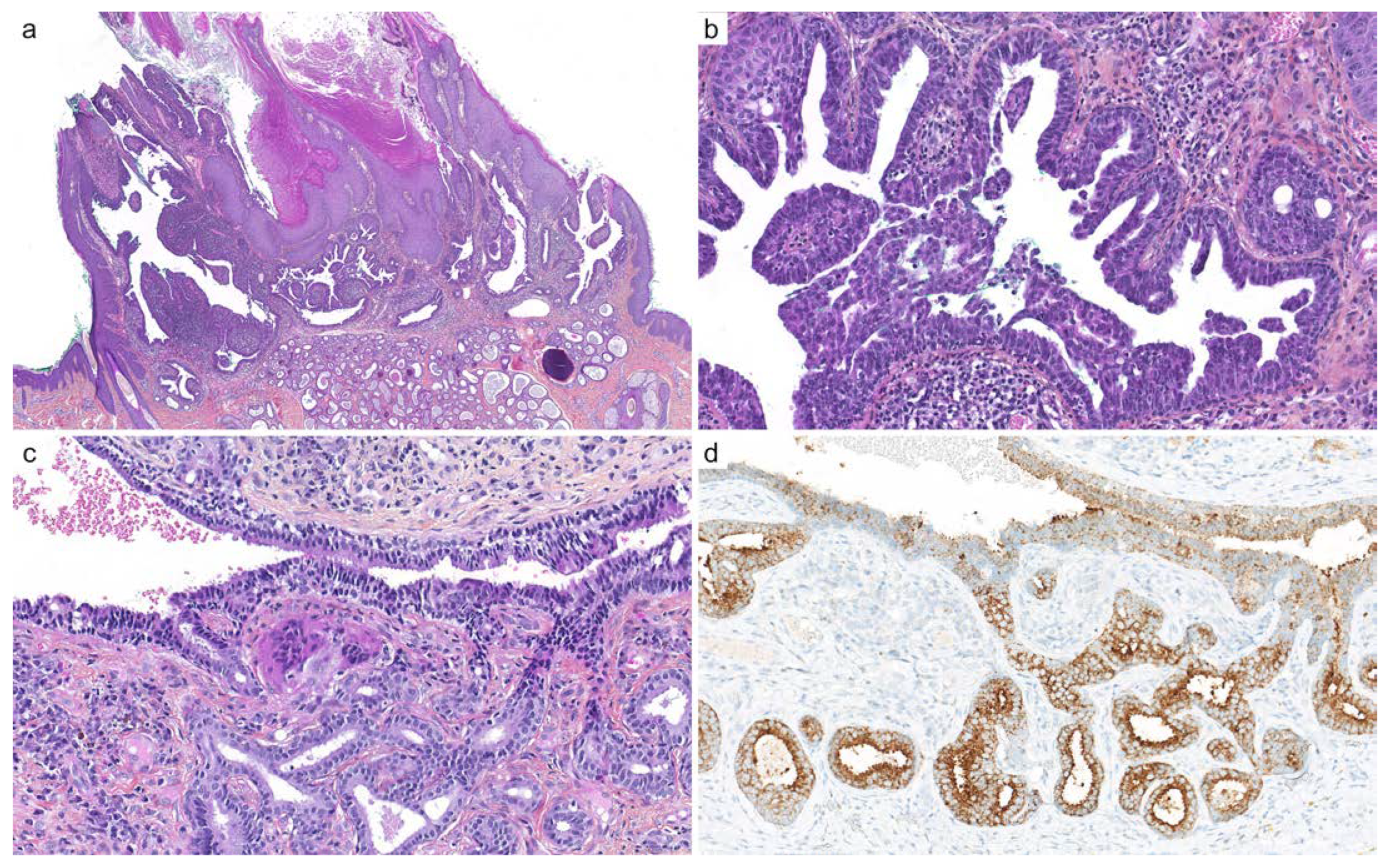 Cancers 14 00476 g008