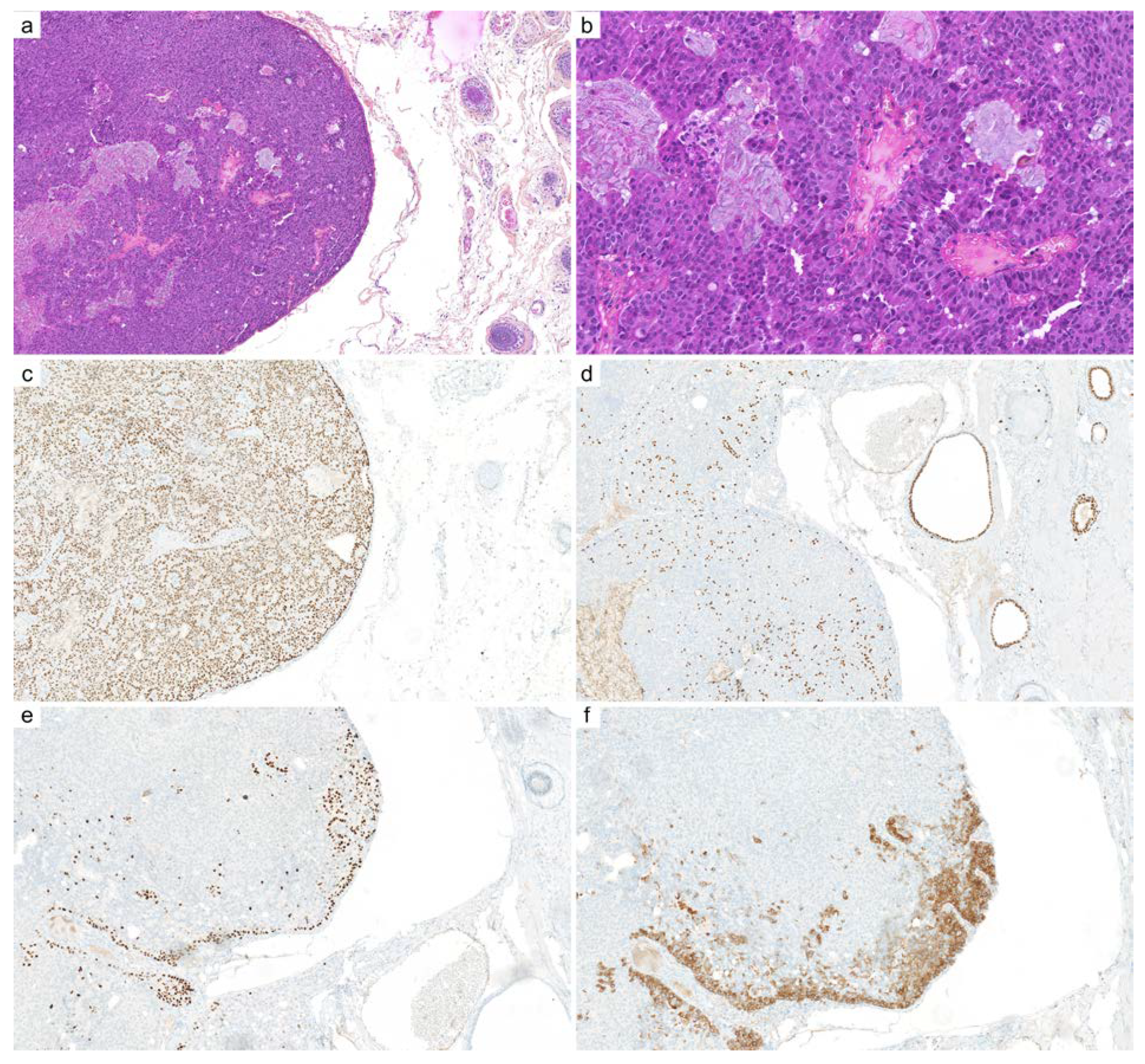 Cancers 14 00476 g009