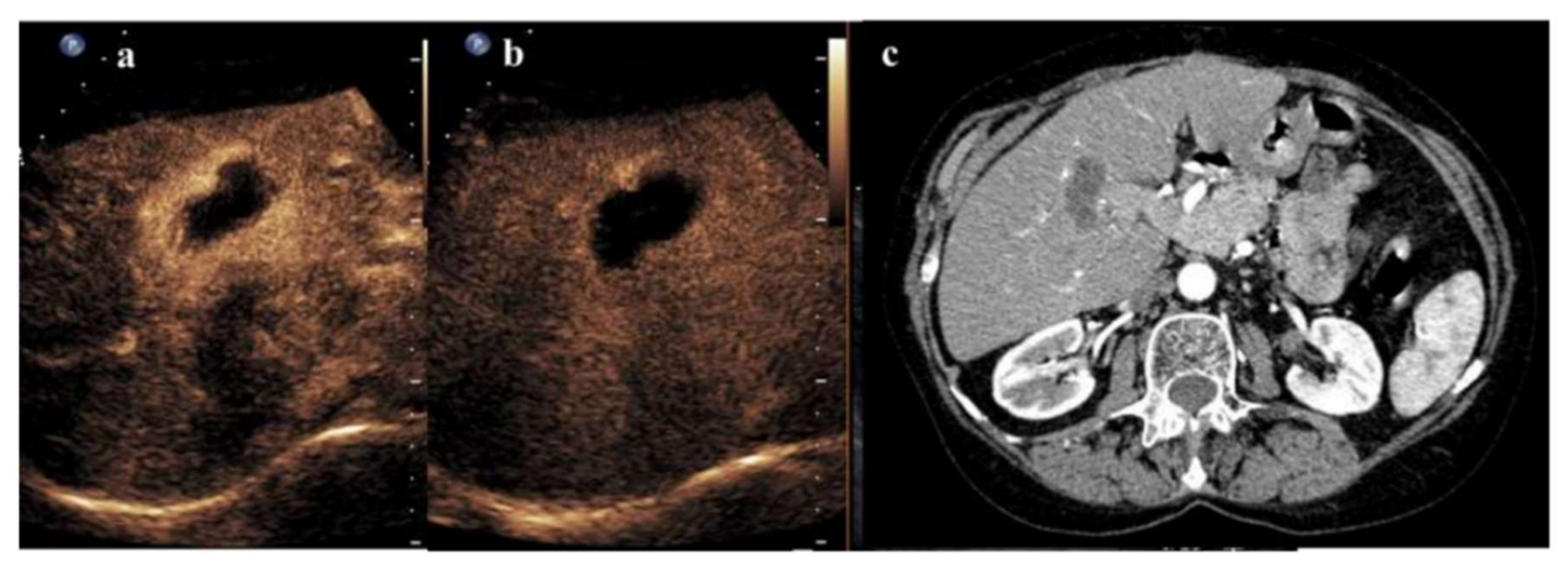 Cancers 14 00481 g002