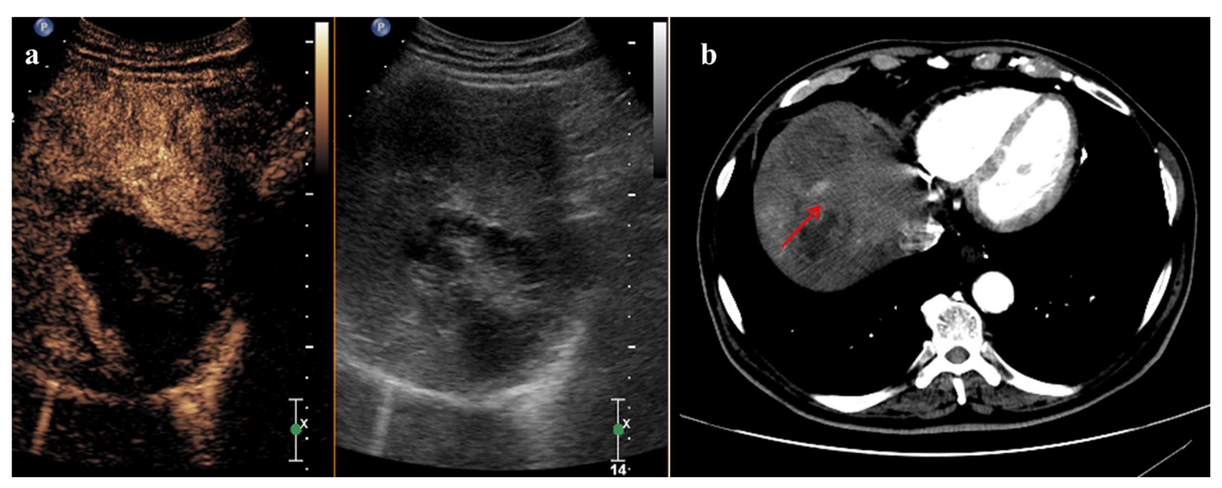 Cancers 14 00481 g003