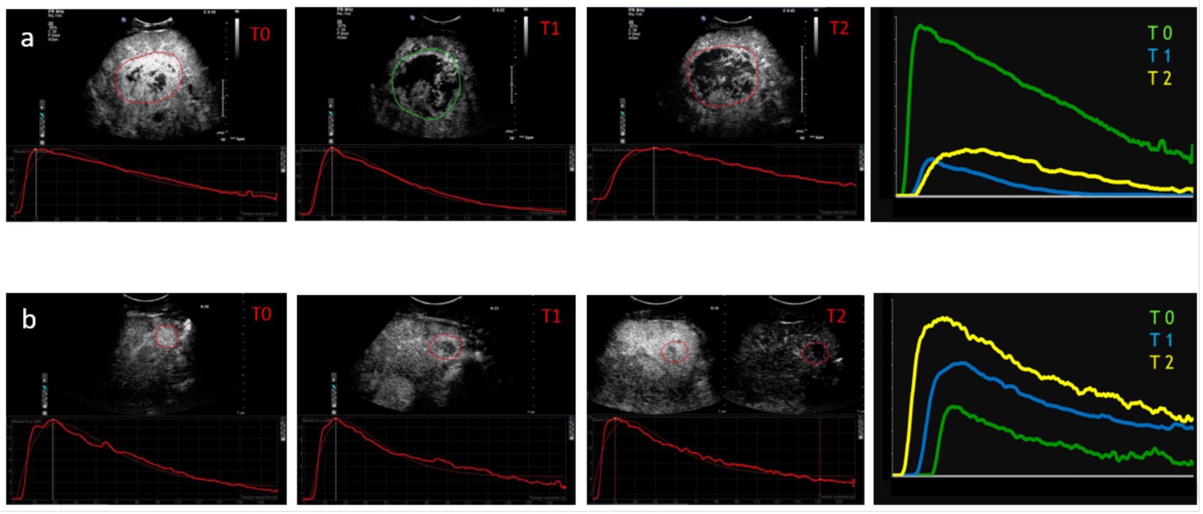Cancers 14 00481 g004