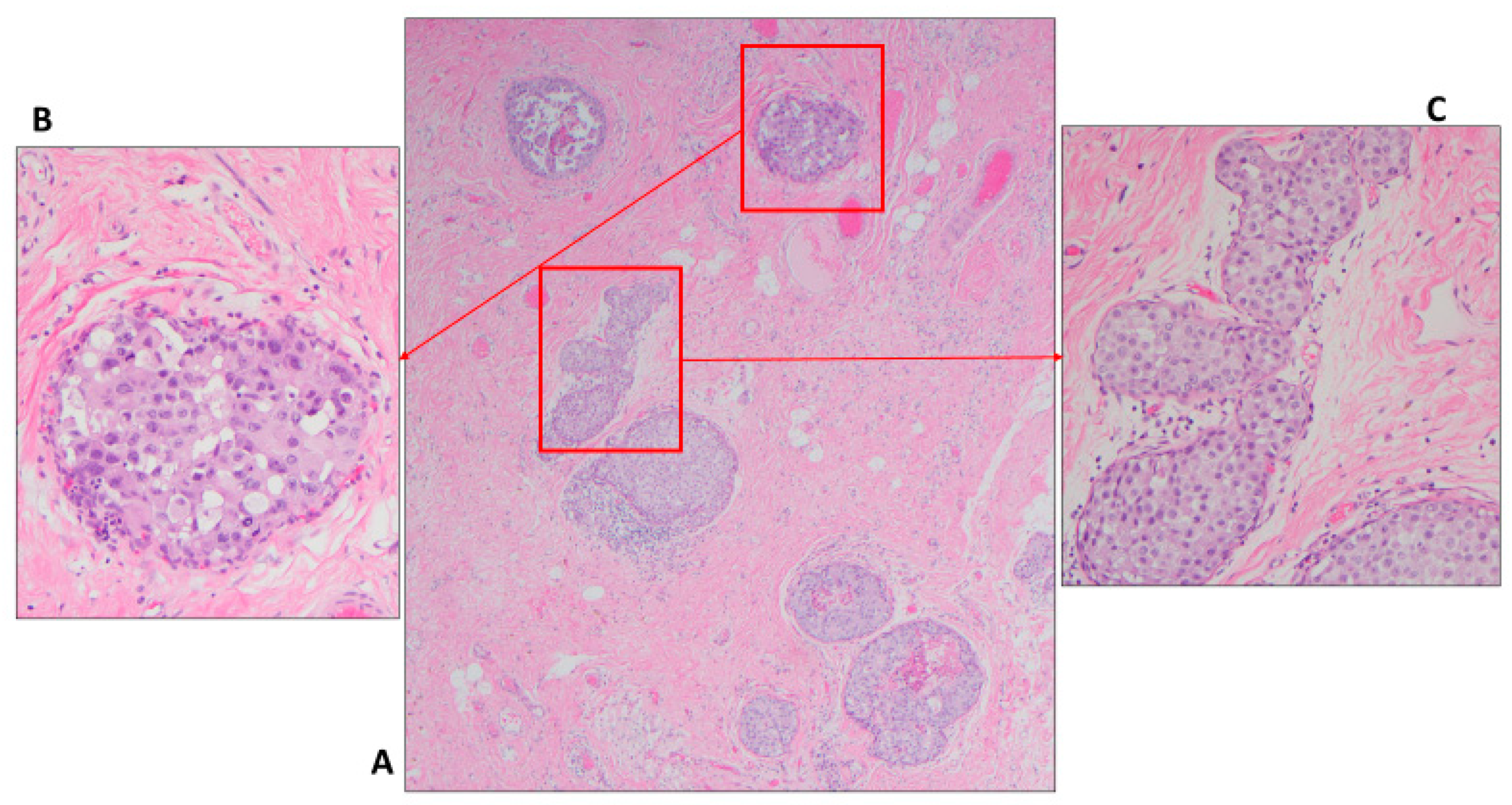 Cancers 14 00507 g006 550