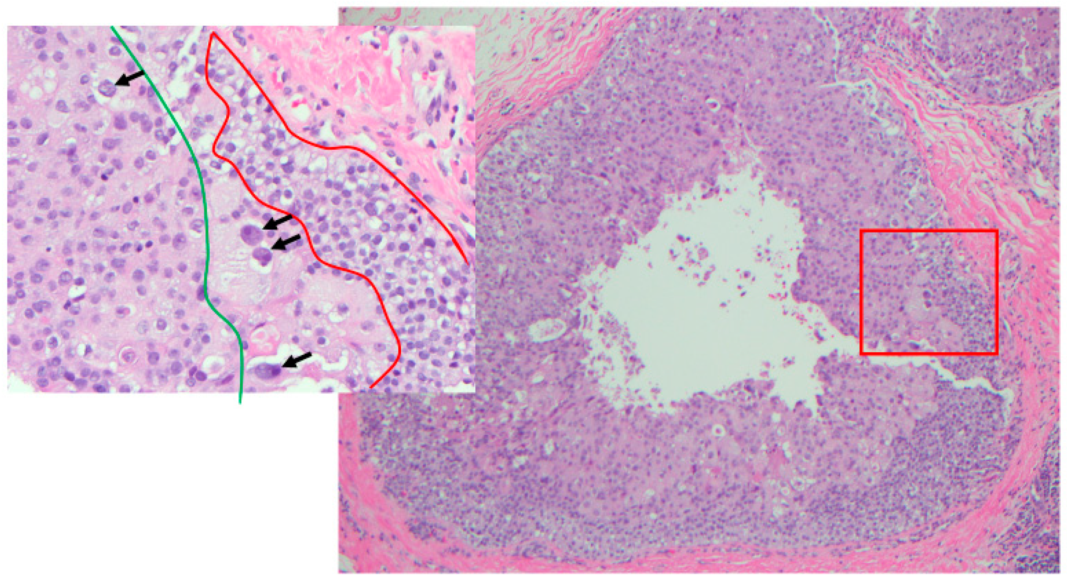 Cancers 14 00507 g007 550