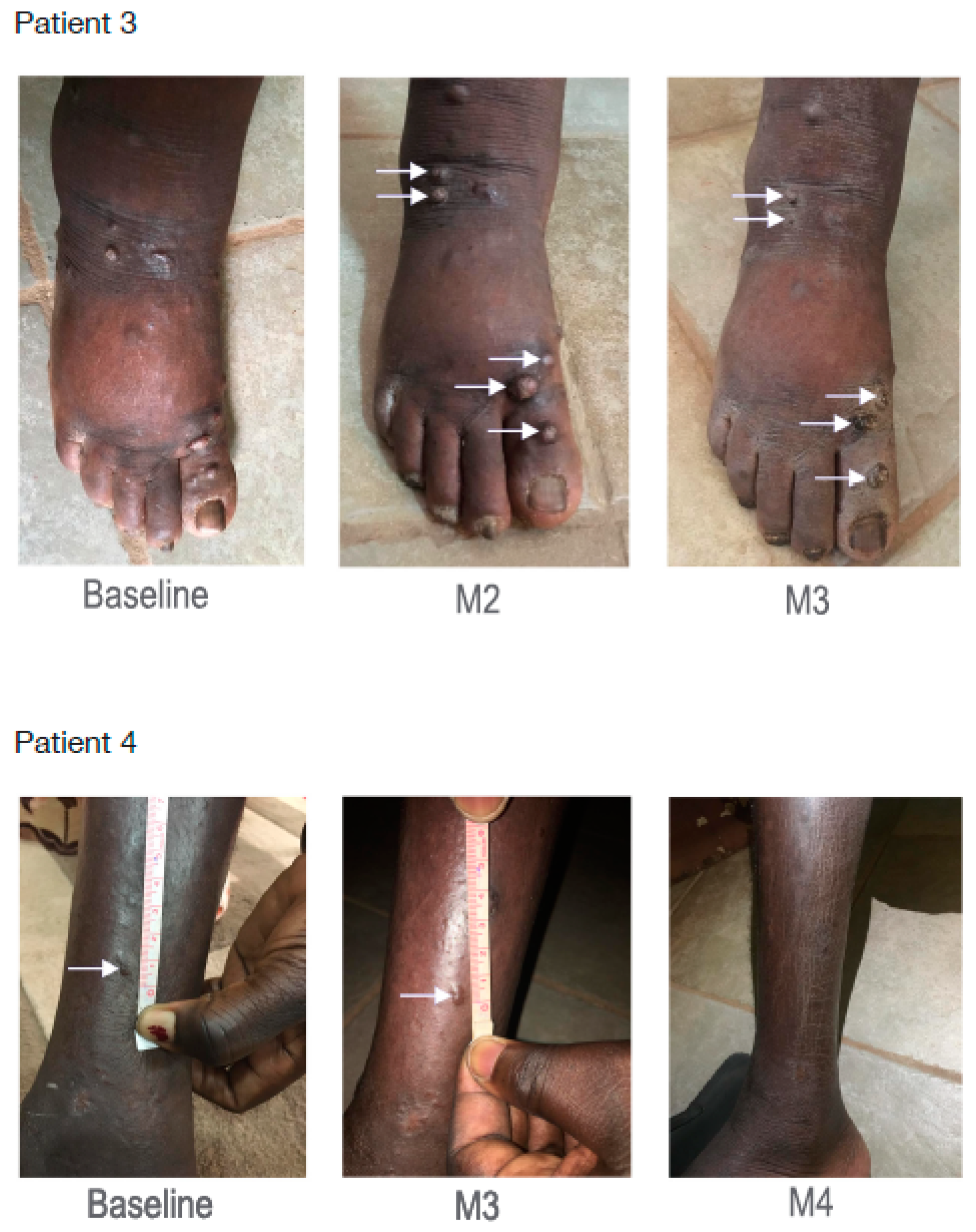 Cancers 14 00543 g008