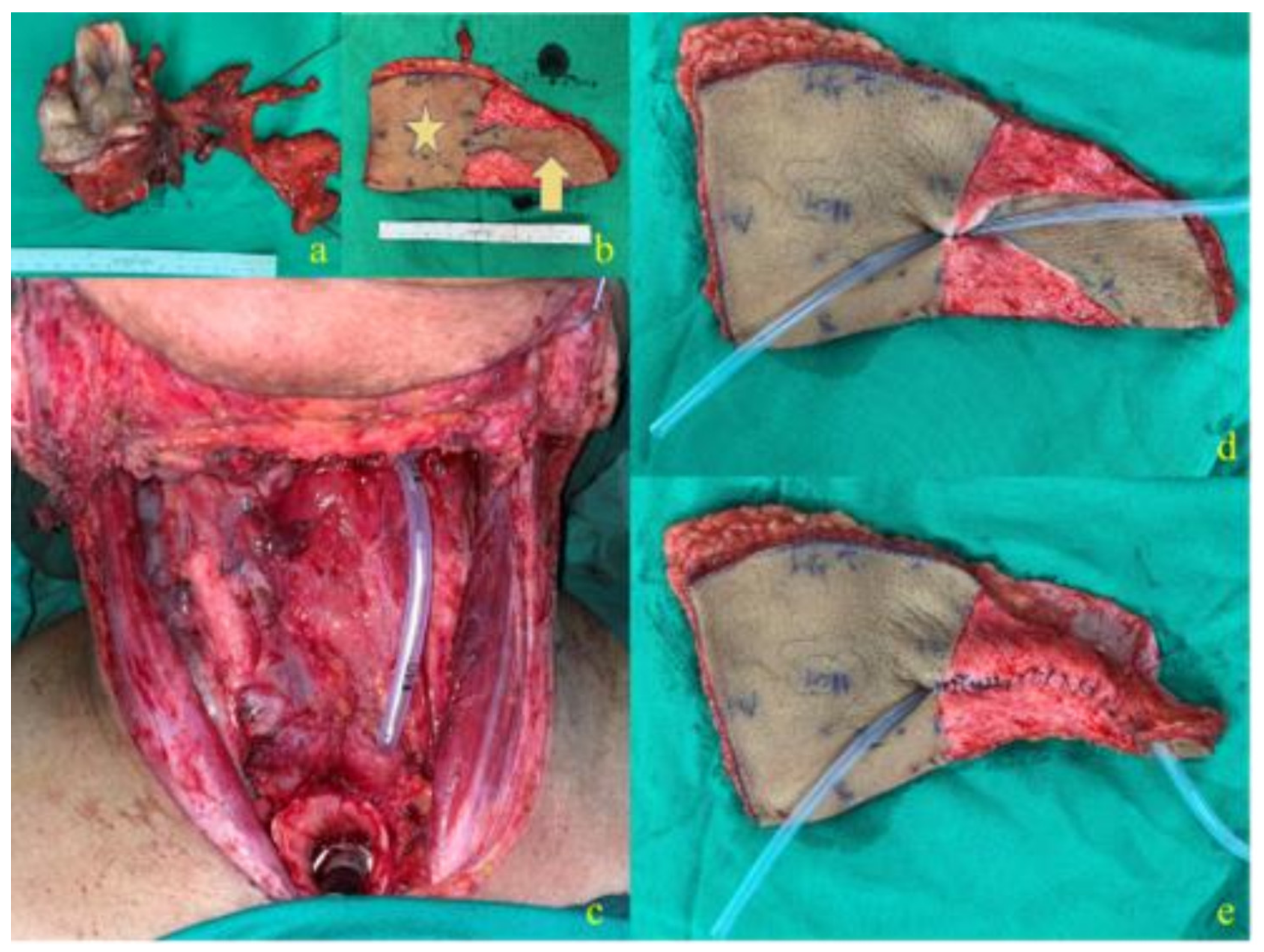 Cancers 14 00544 g001 550