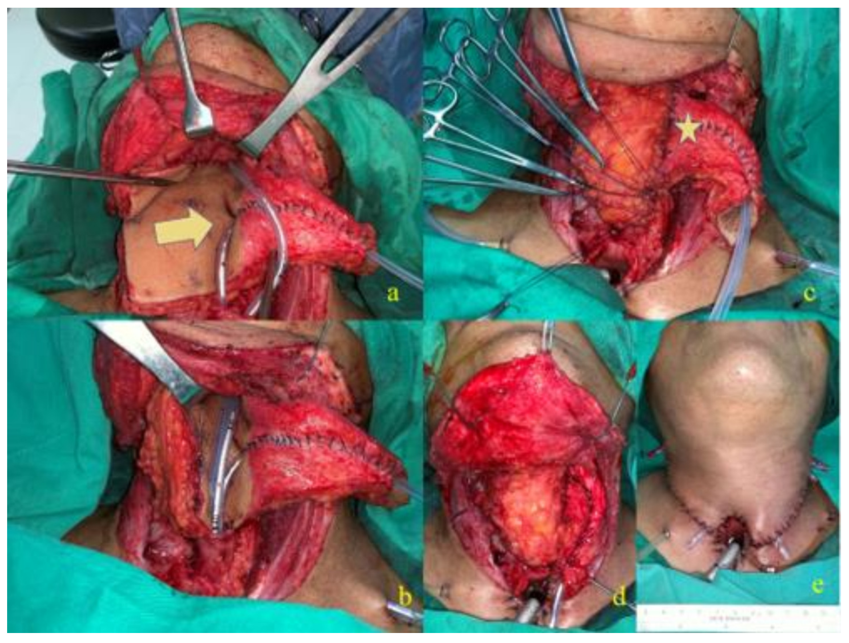 Cancers 14 00544 g002 550