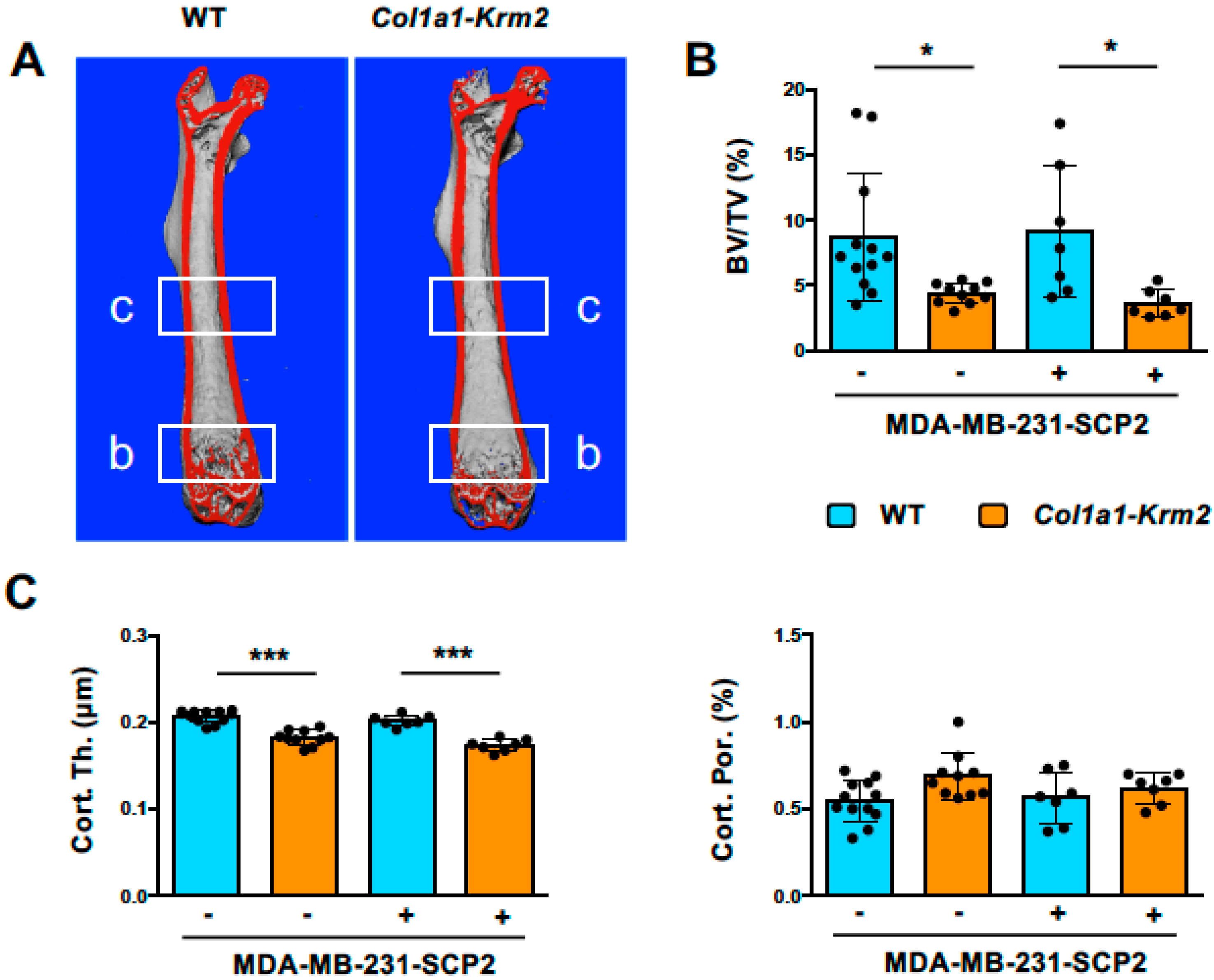 PDZK1 inhibits MRP2-mediated oxaliplatin chemosensitivity in