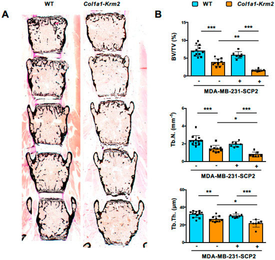 Tumorigenic mesenchymal clusters are less sensitive to
