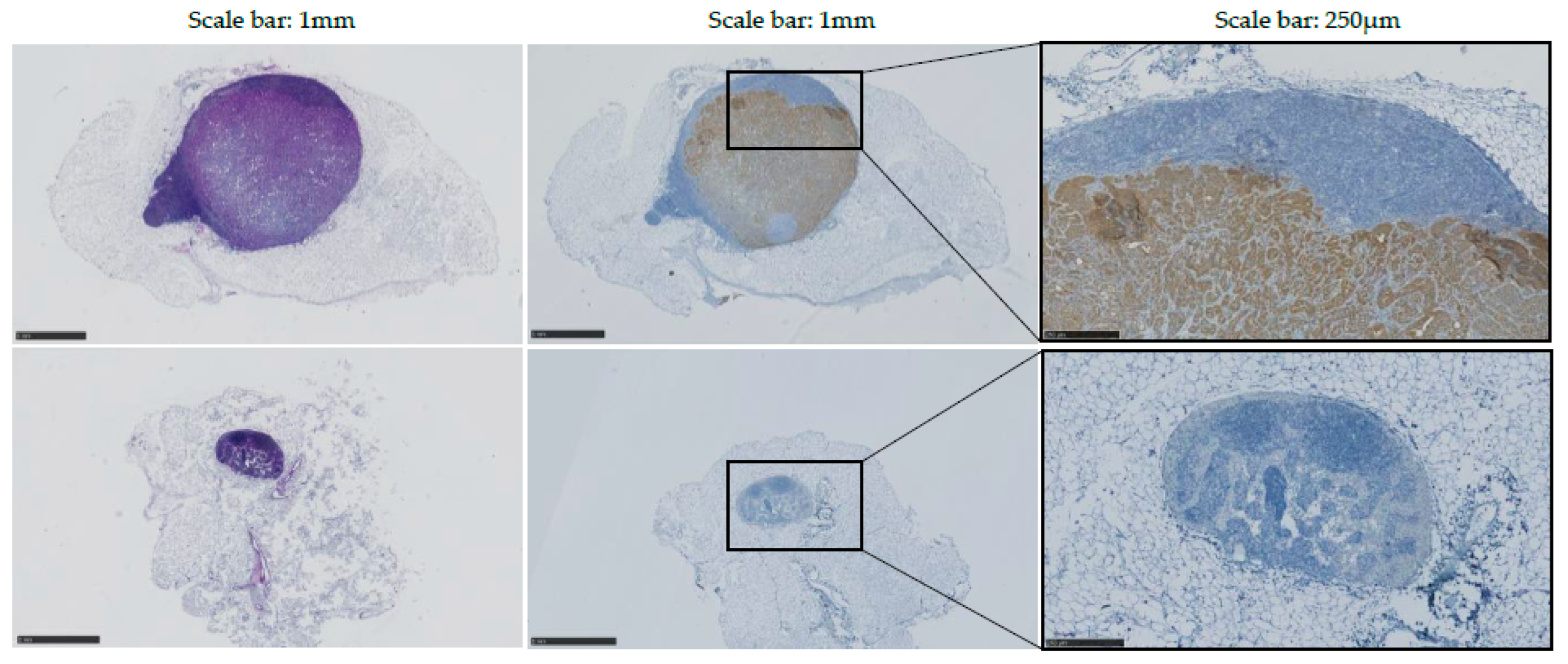 Cancers 14 00561 g008