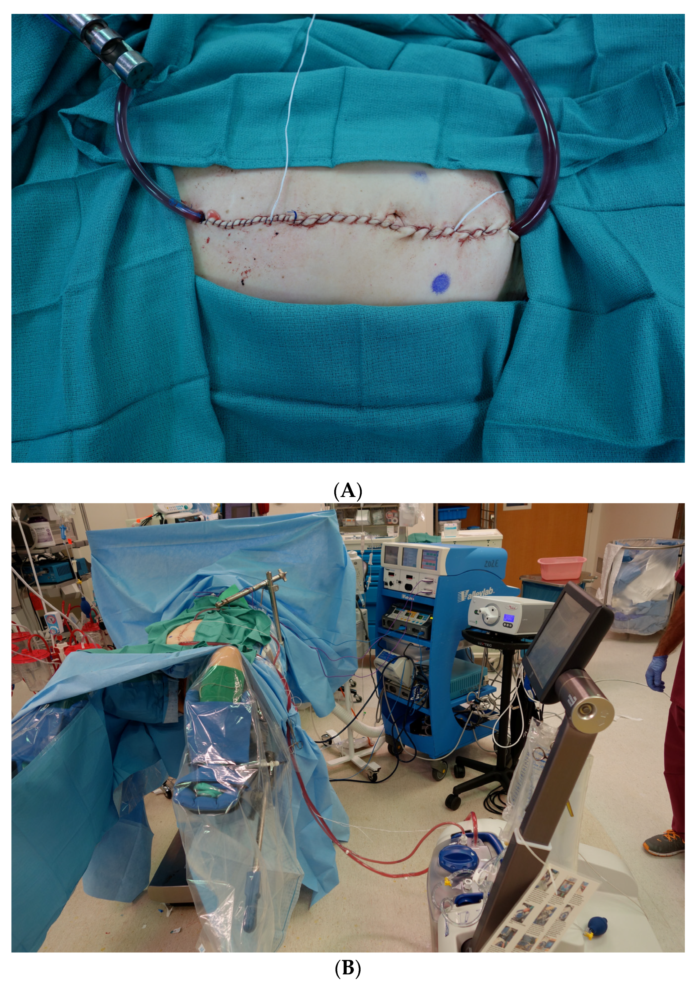 Cancers 14 00570 g001 Cancers 14 00570 g001