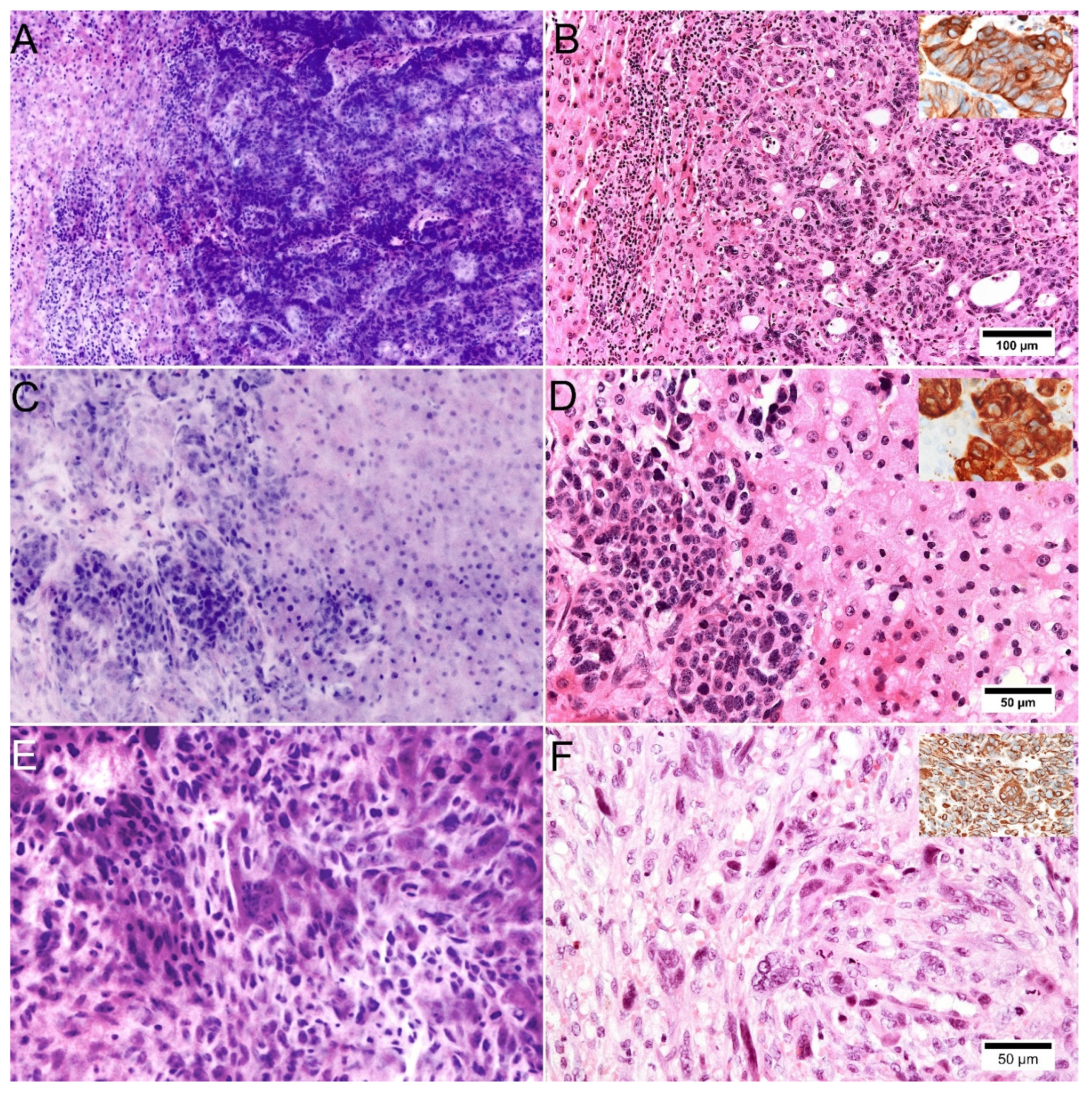 Cancers 14 00590 g004 550