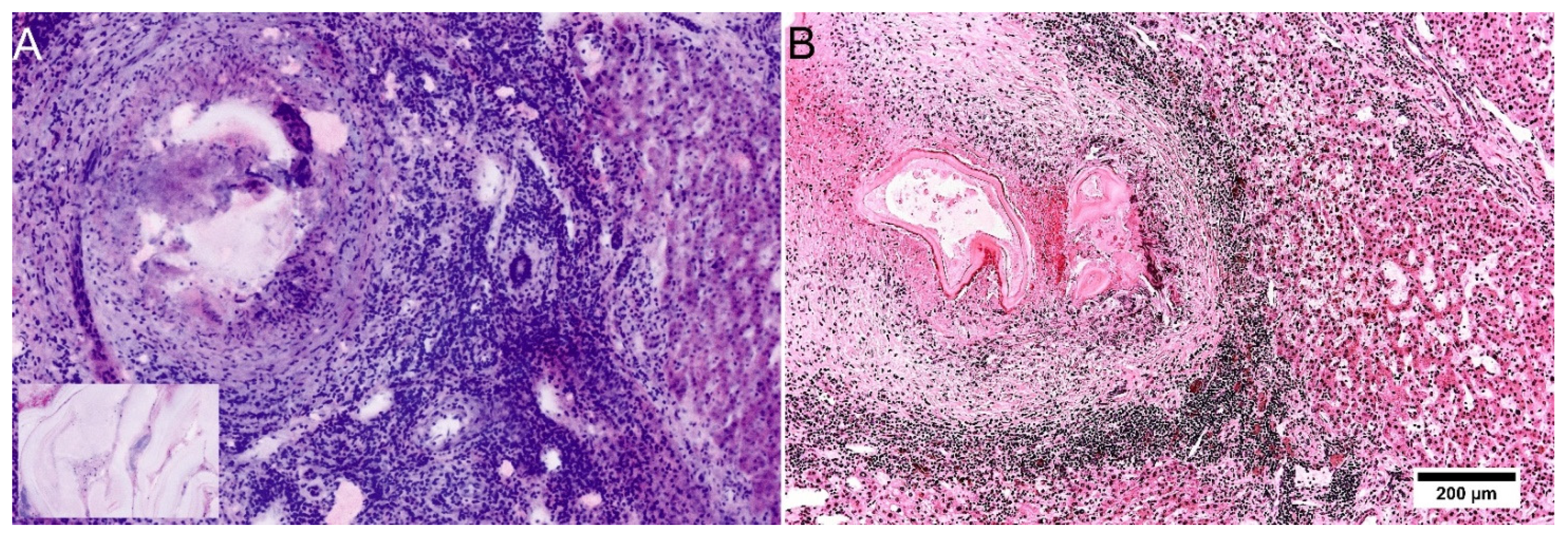Cancers 14 00590 g007 550