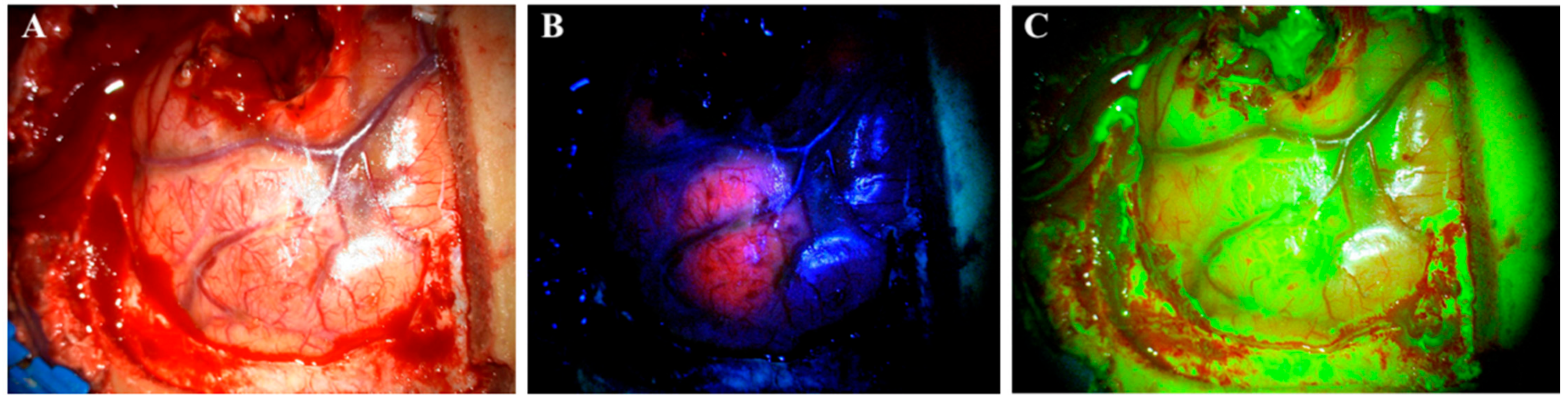 Cancers 14 00617 g001 550