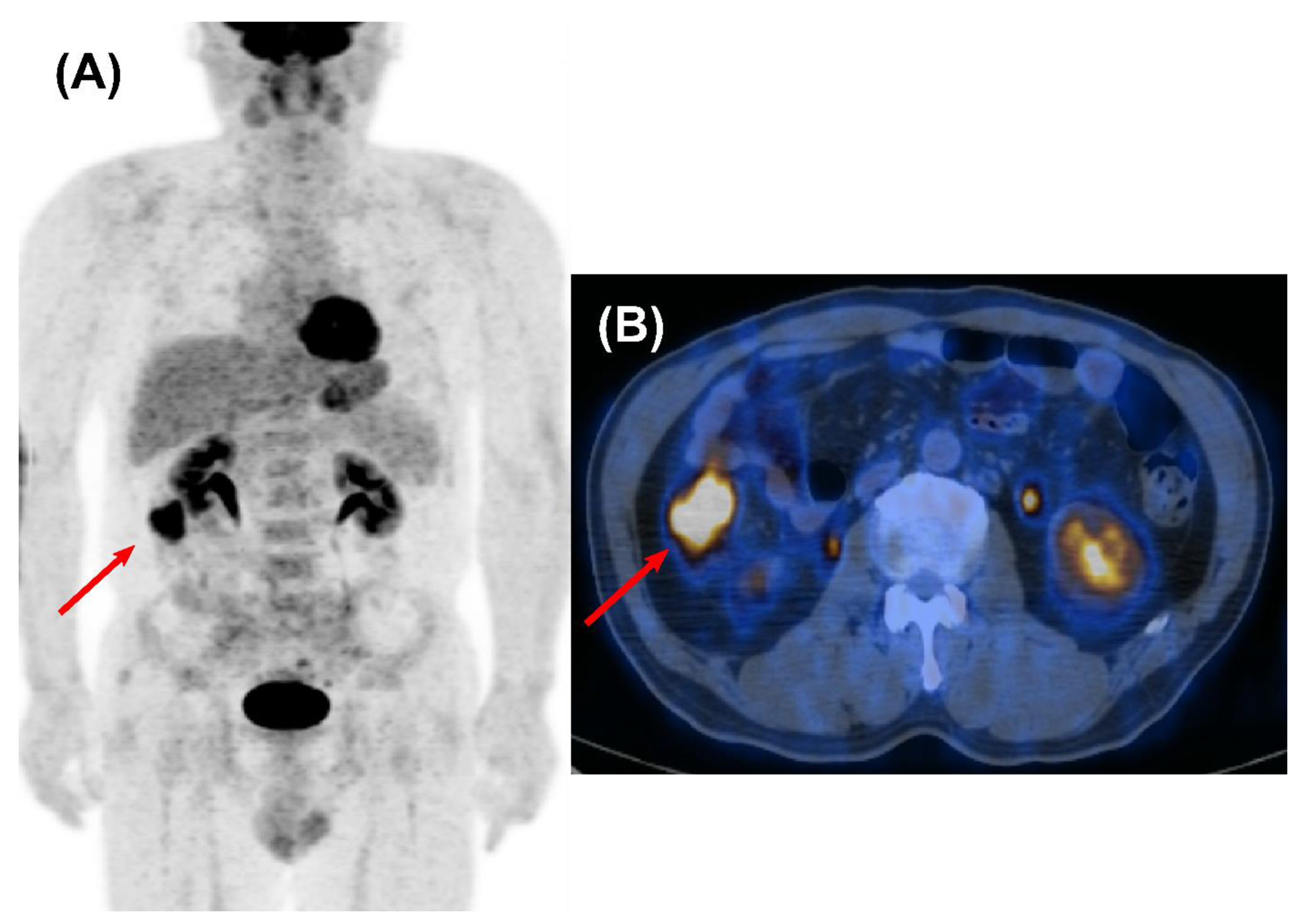 Cancers 14 00632 g003 Cancers 14 00632 g003