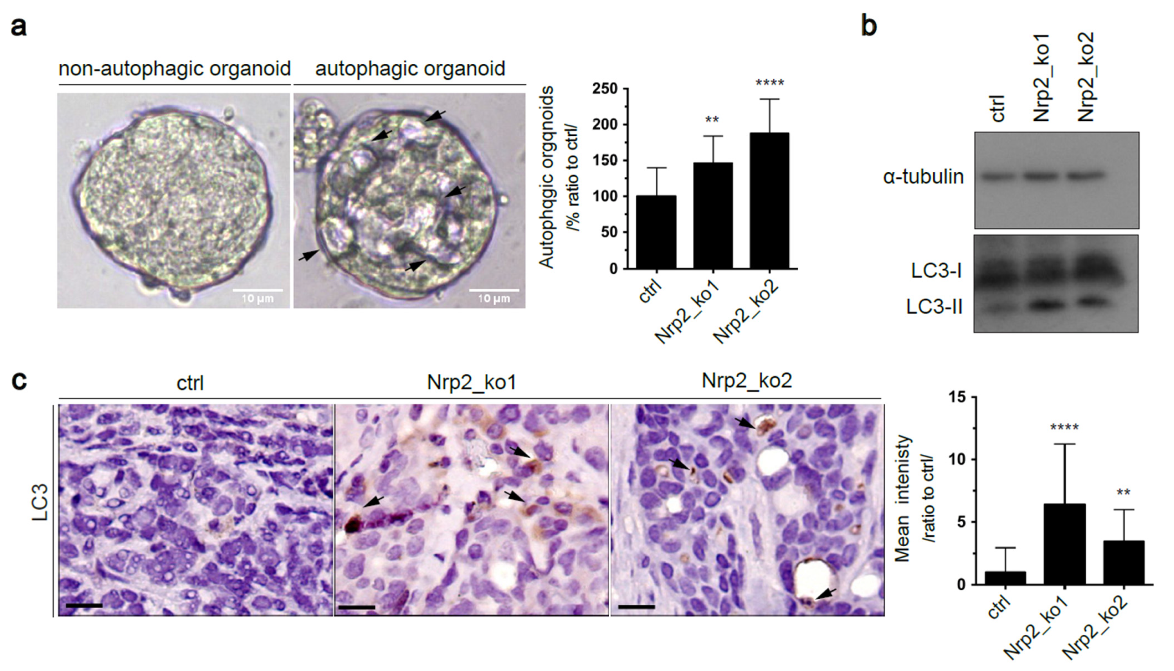 Cancers 14 00671 g005 550