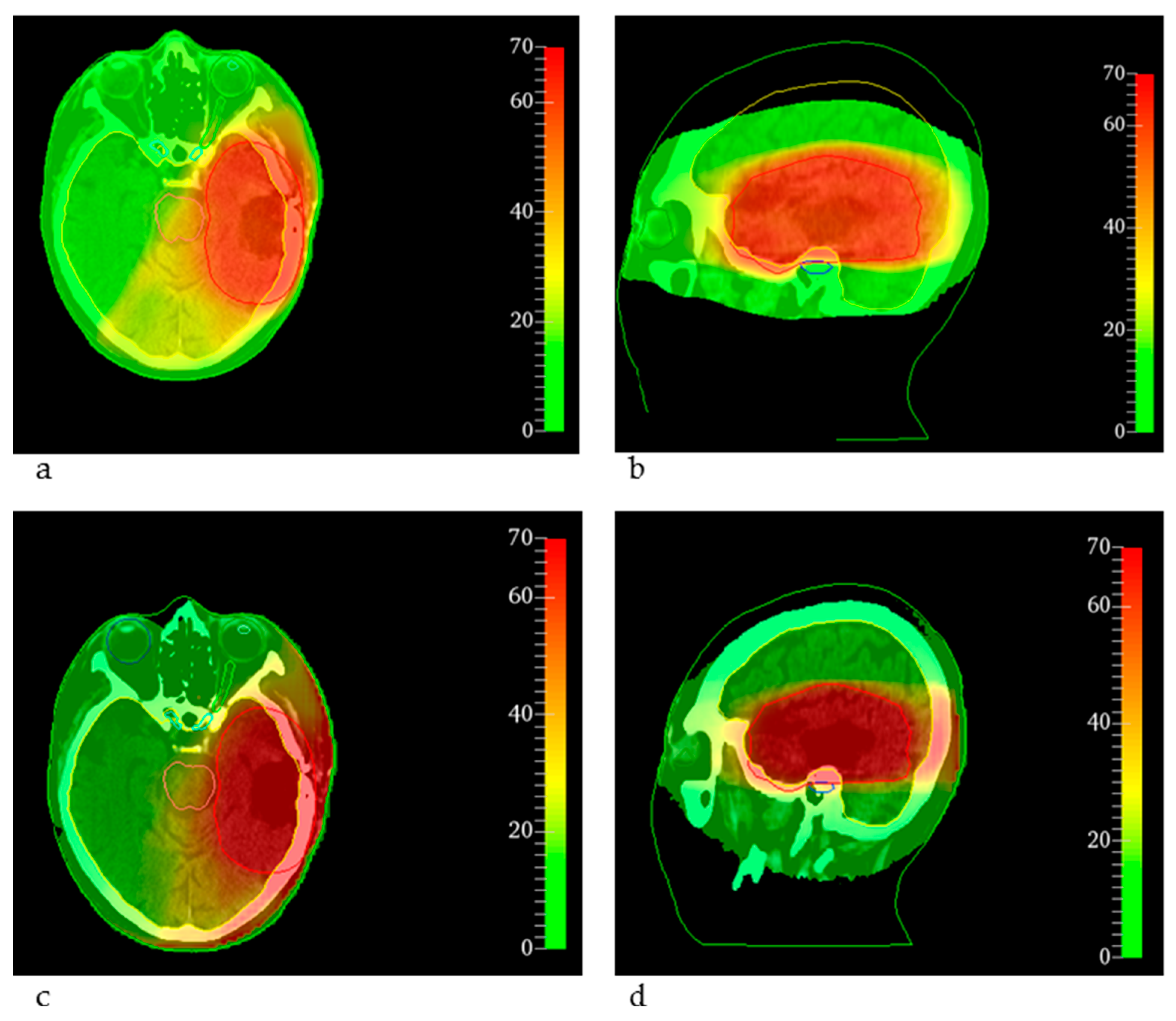 Cancers 14 00685 g002