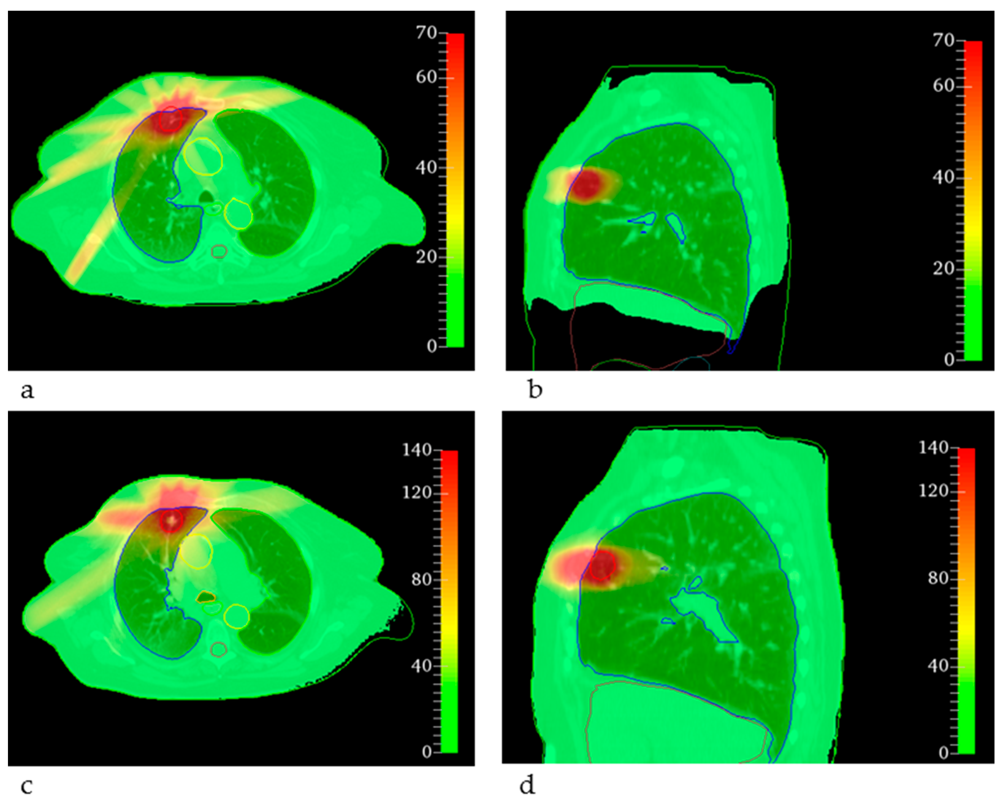 Cancers 14 00685 g003