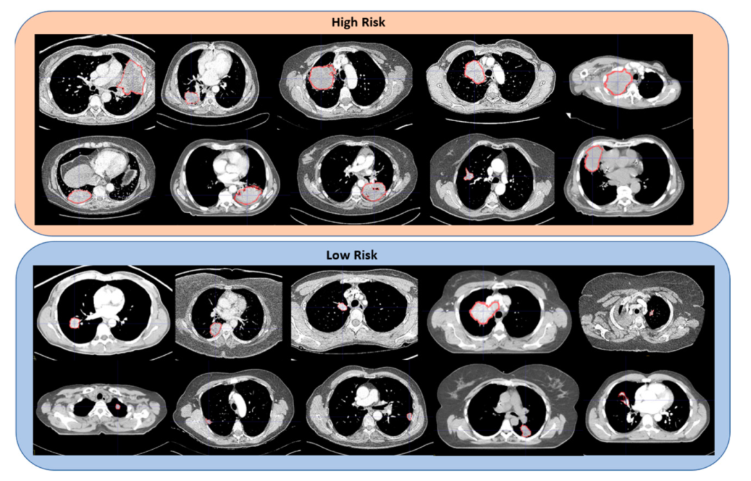 Cancers 14 00700 g003 550