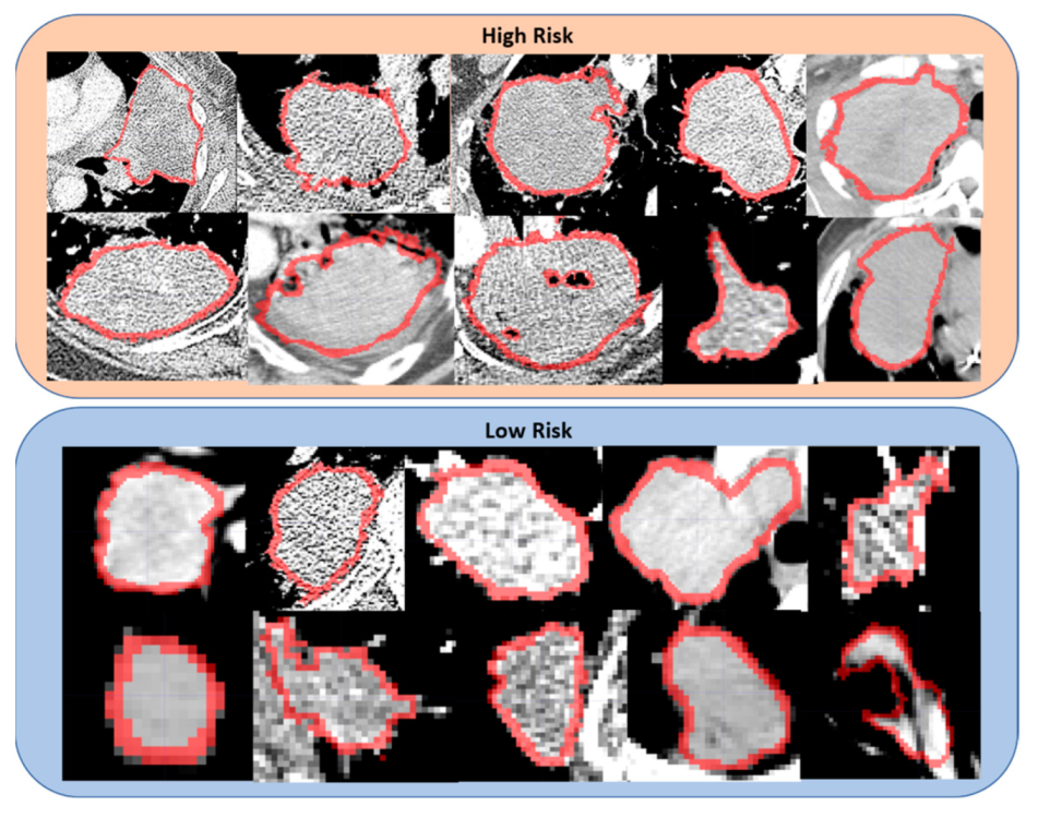 Cancers 14 00700 g004 550