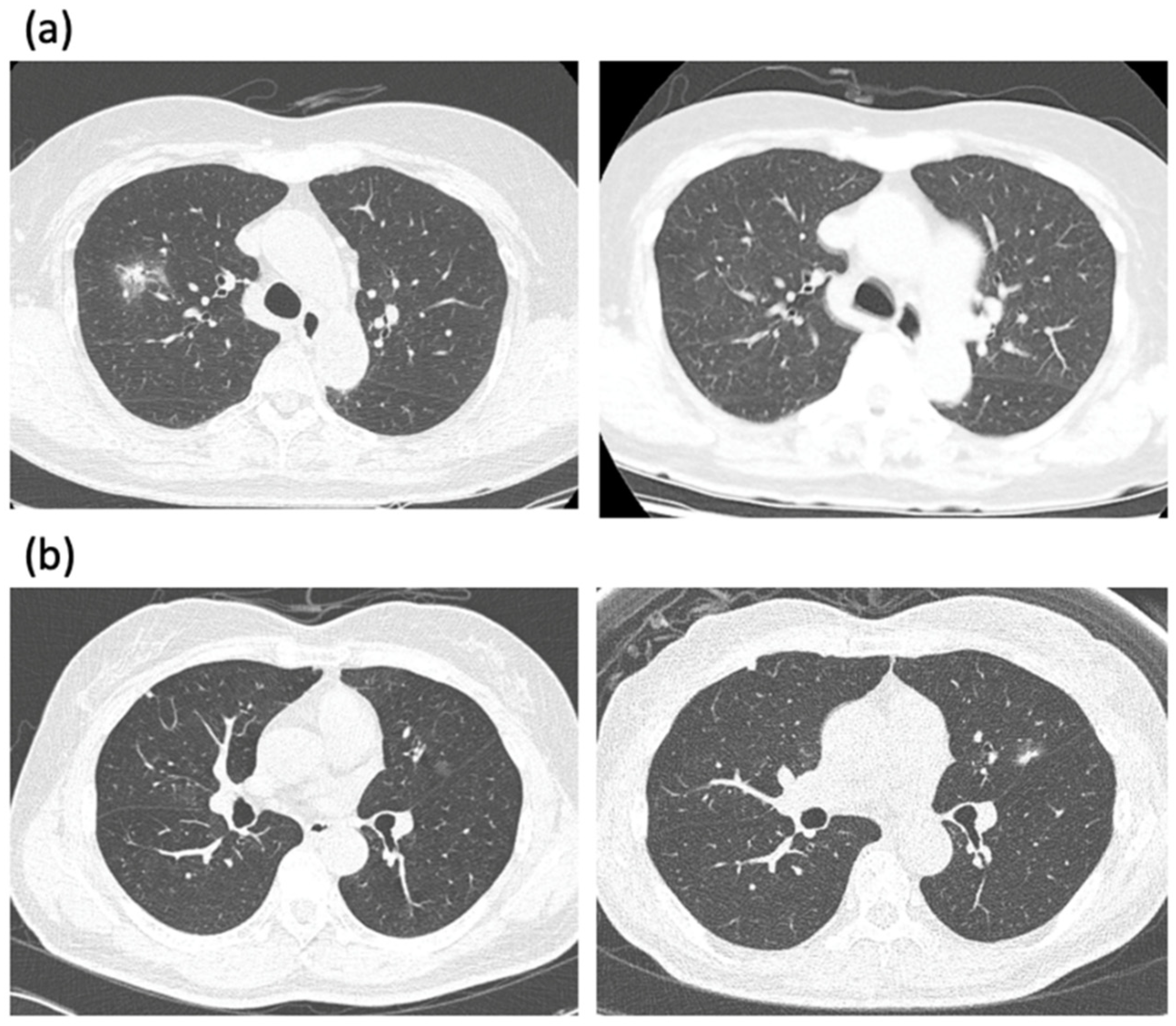 Cancers 14 00715 g001