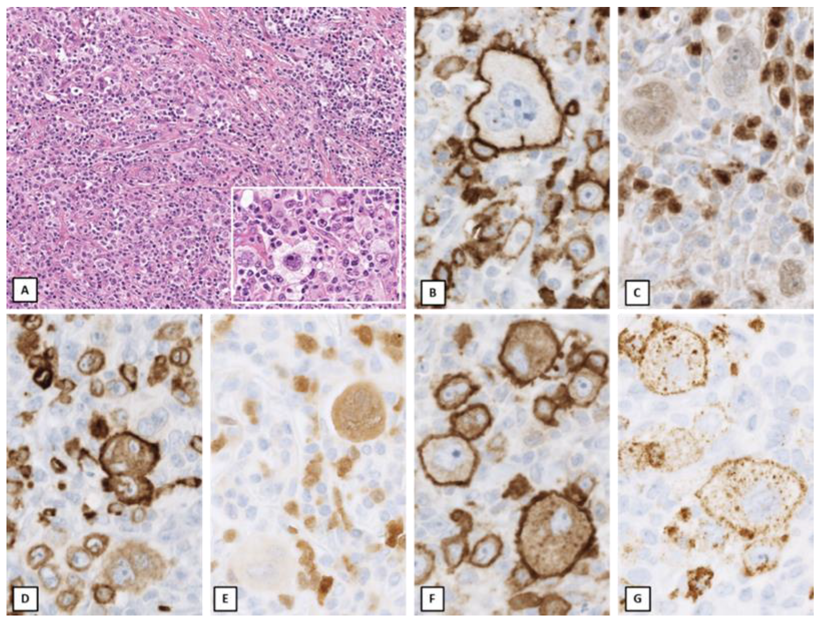 Cancers 14 00742 g002 550