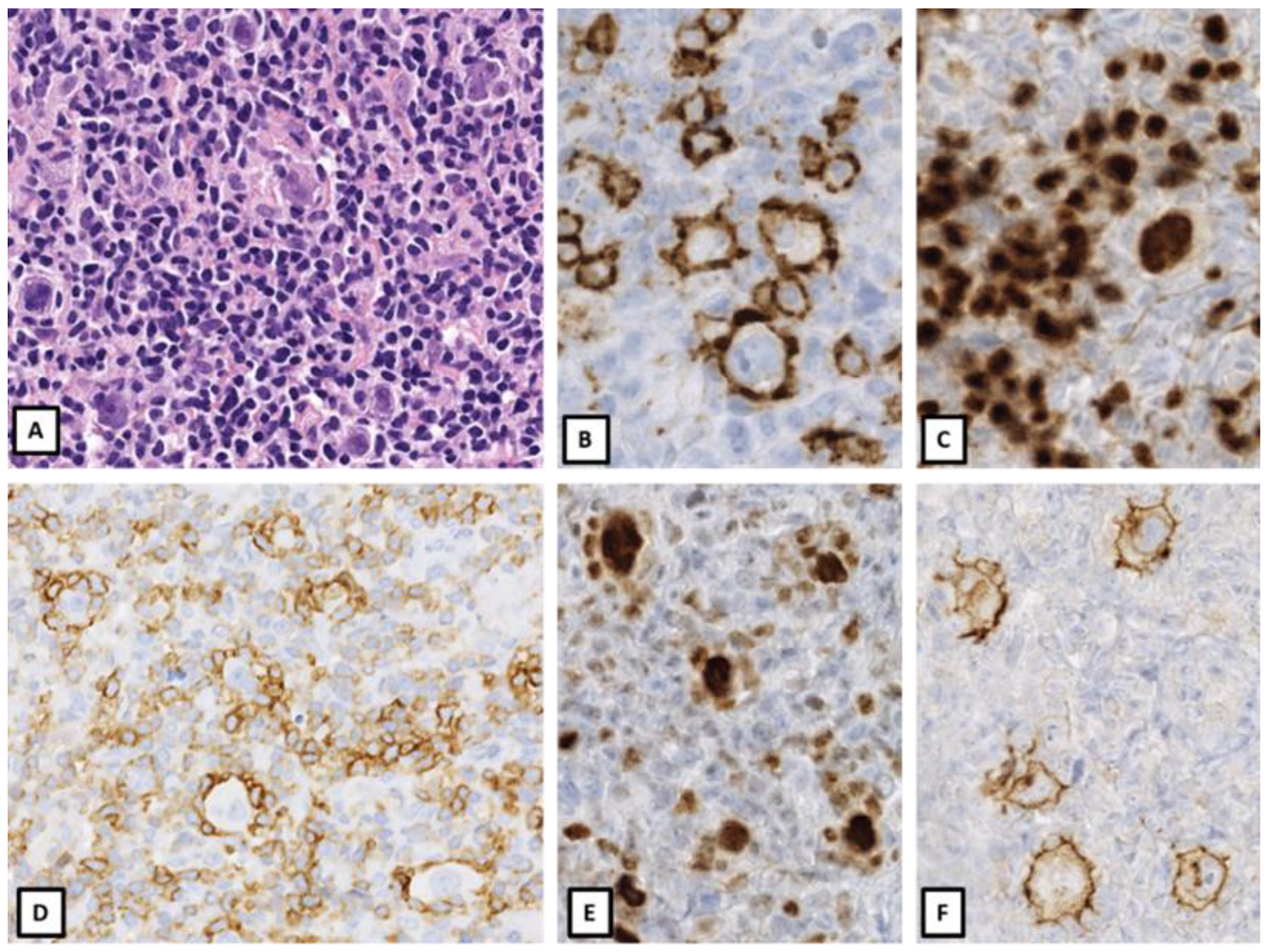 Cancers 14 00742 g003 550