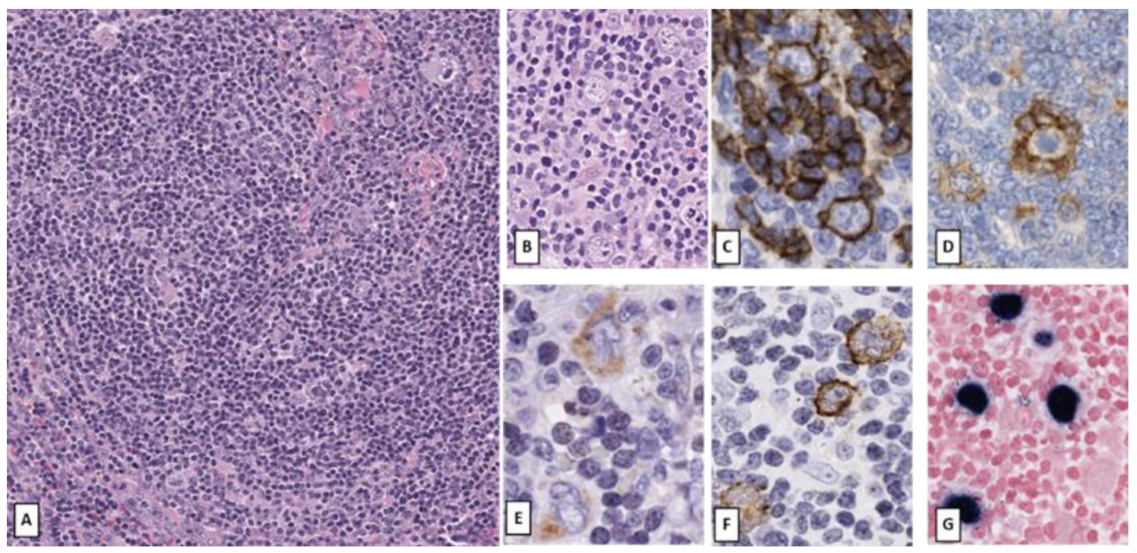 Cancers 14 00742 g004 550