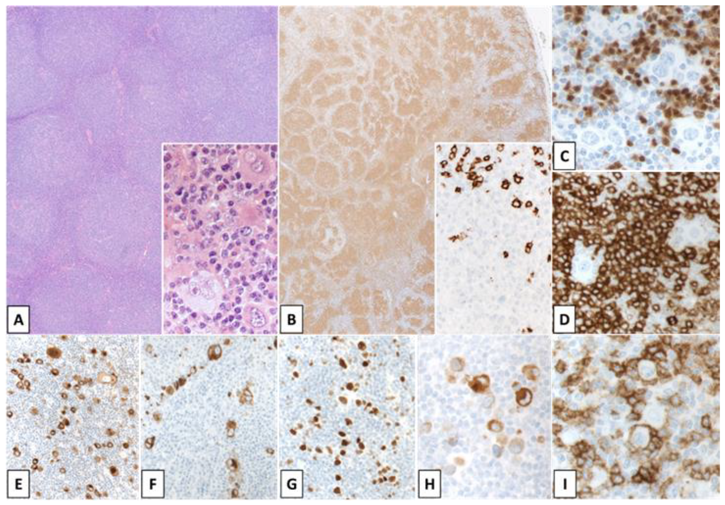 Cancers 14 00742 g006 550