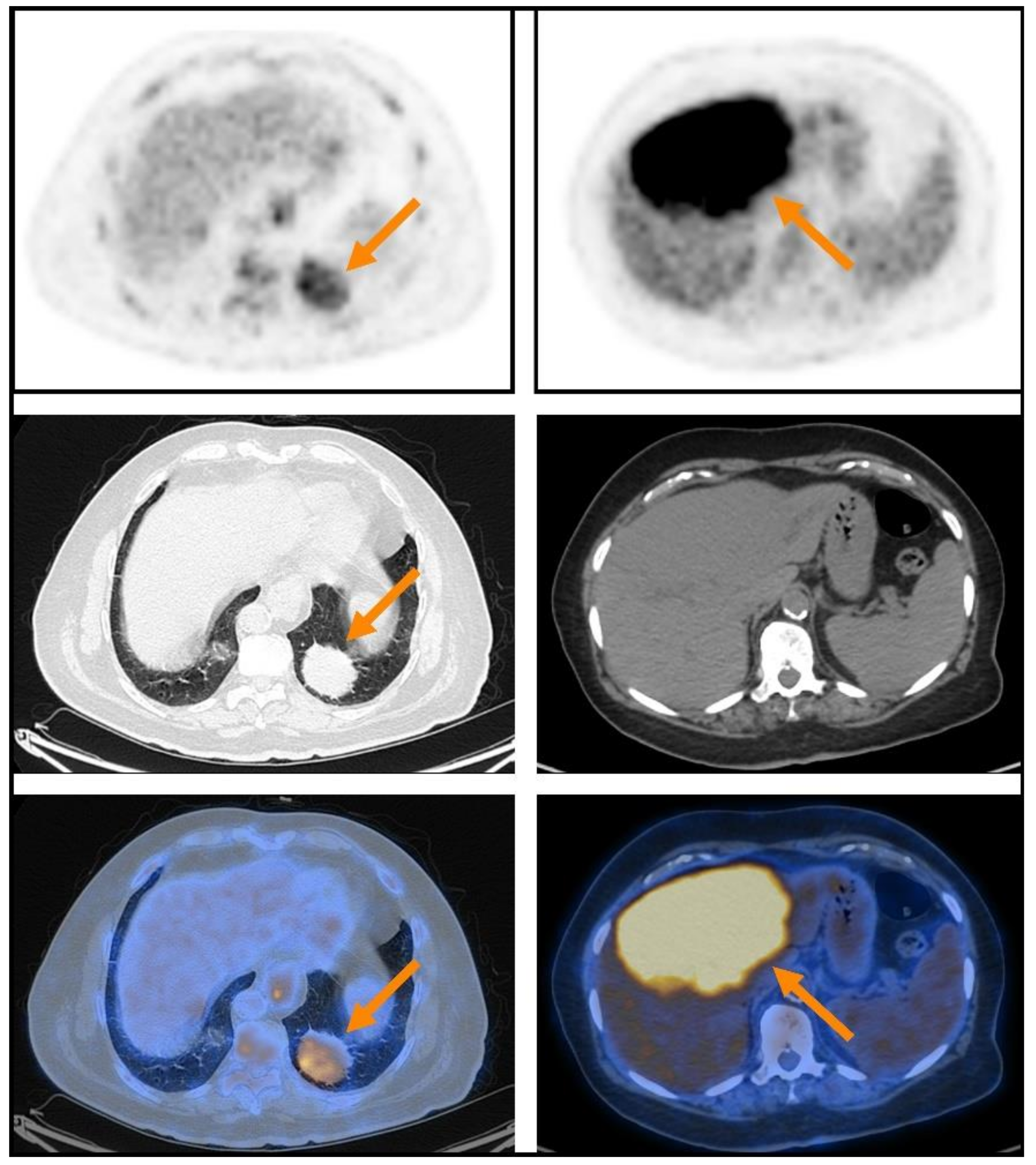 Cancers 14 00750 g001