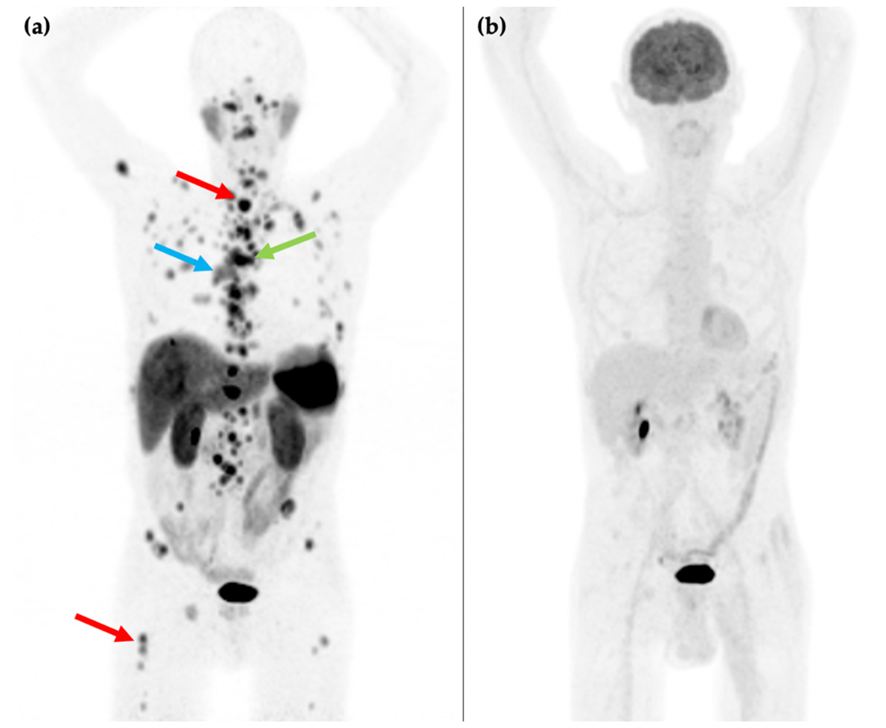 Cancers 14 00761 g002 Cancers 14 00761 g002