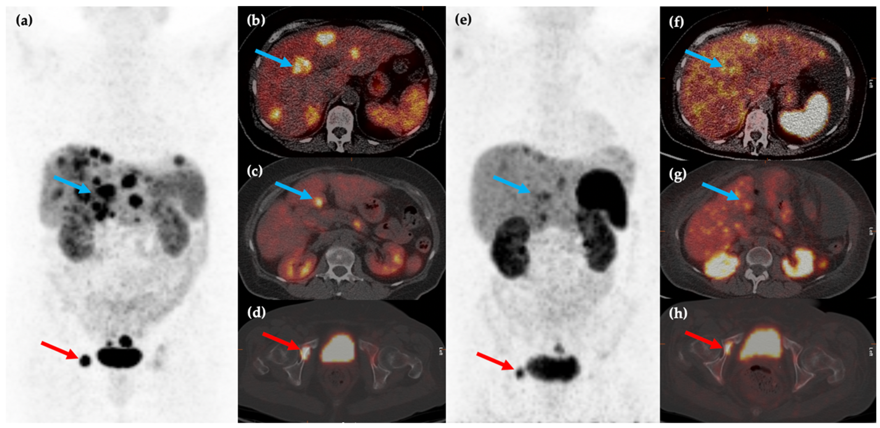Cancers 14 00761 g003 Cancers 14 00761 g003